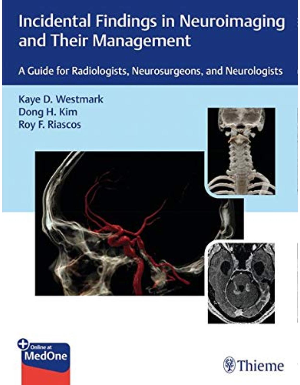 Incidental Findings in Neuroimaging and Their Management: A Guide for Radiologists, Neurosurgeons, and Neurologists