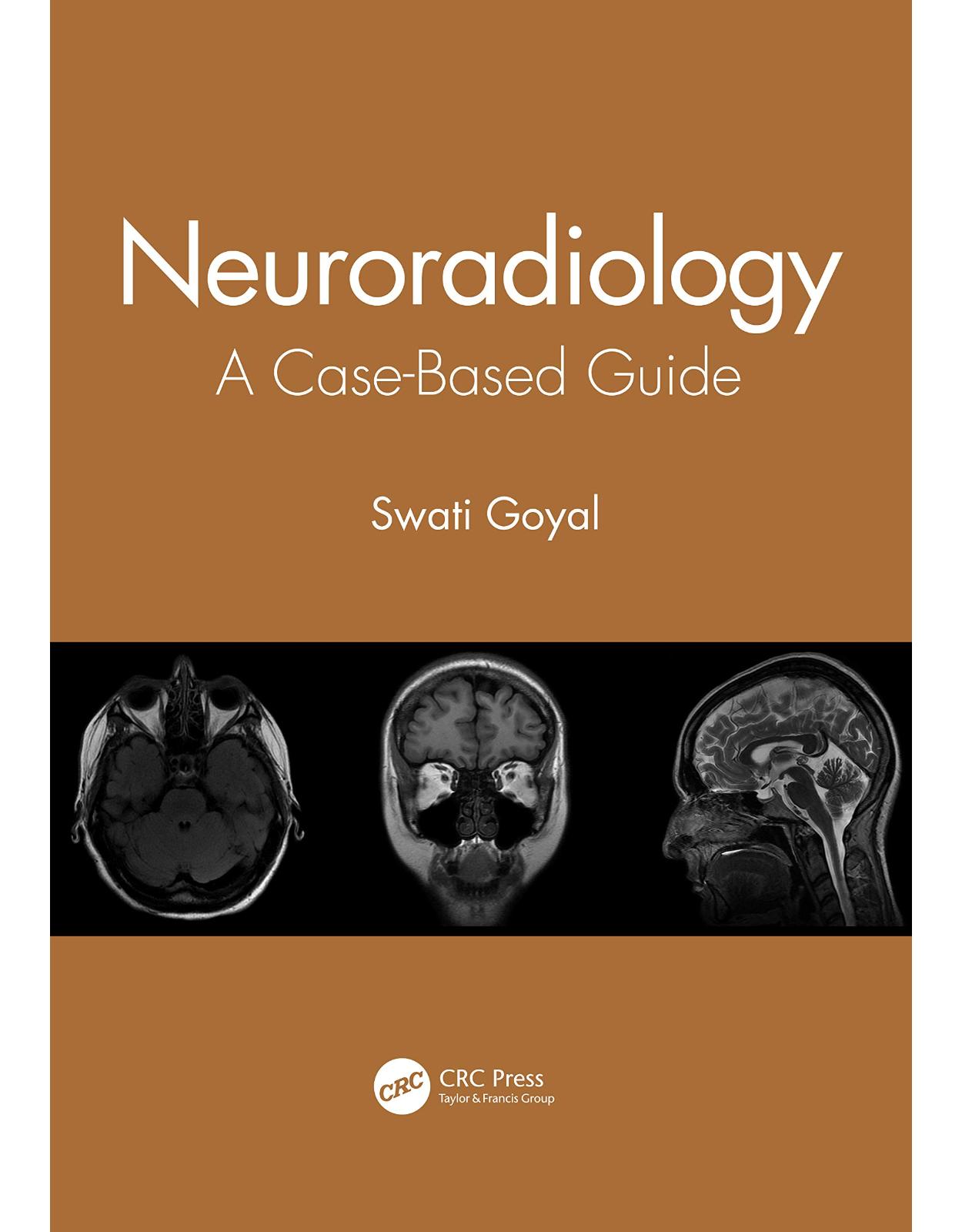 Neuroradiology: A Case-Based Guide 