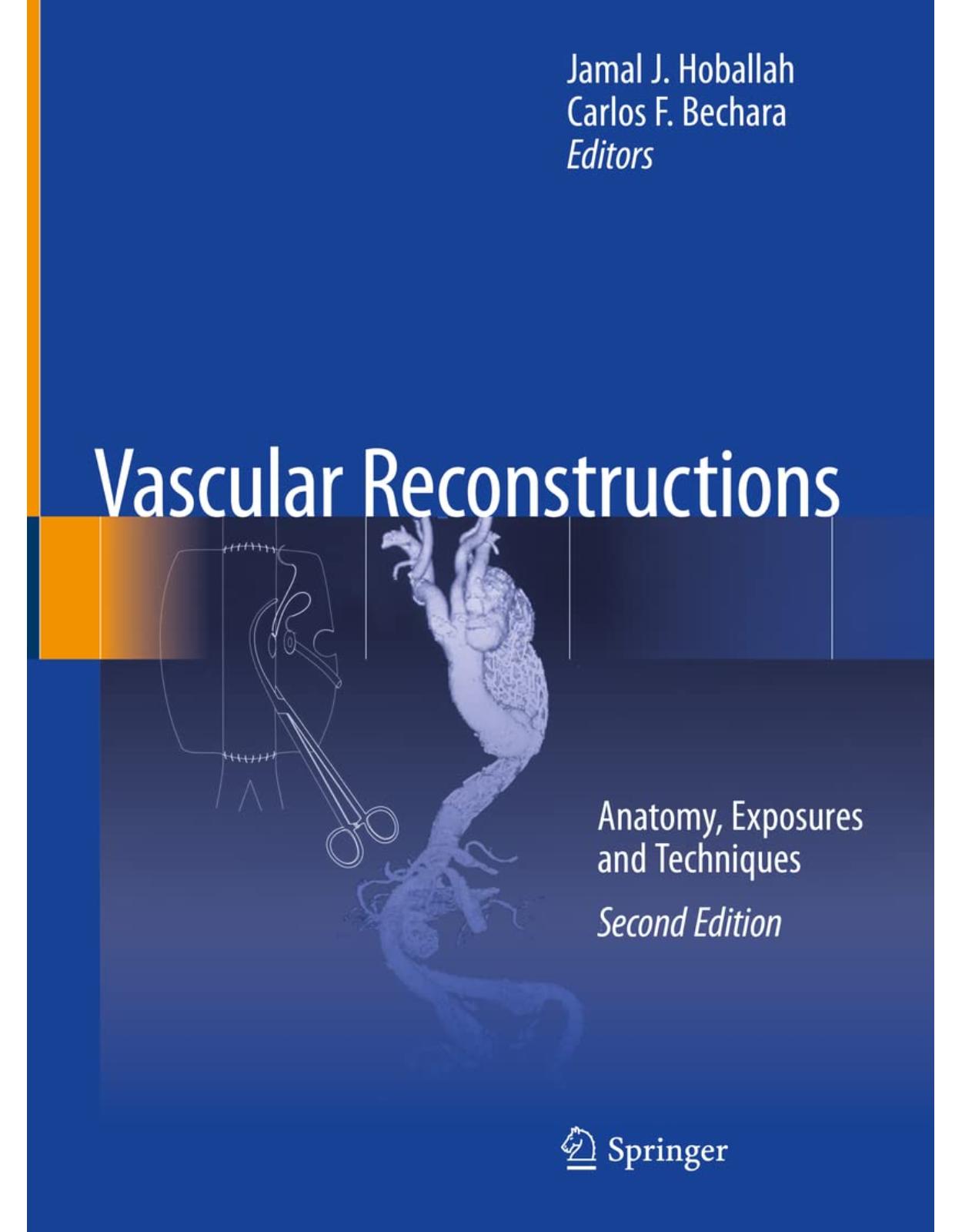 Vascular Reconstructions: Anatomy, Exposures and Techniques