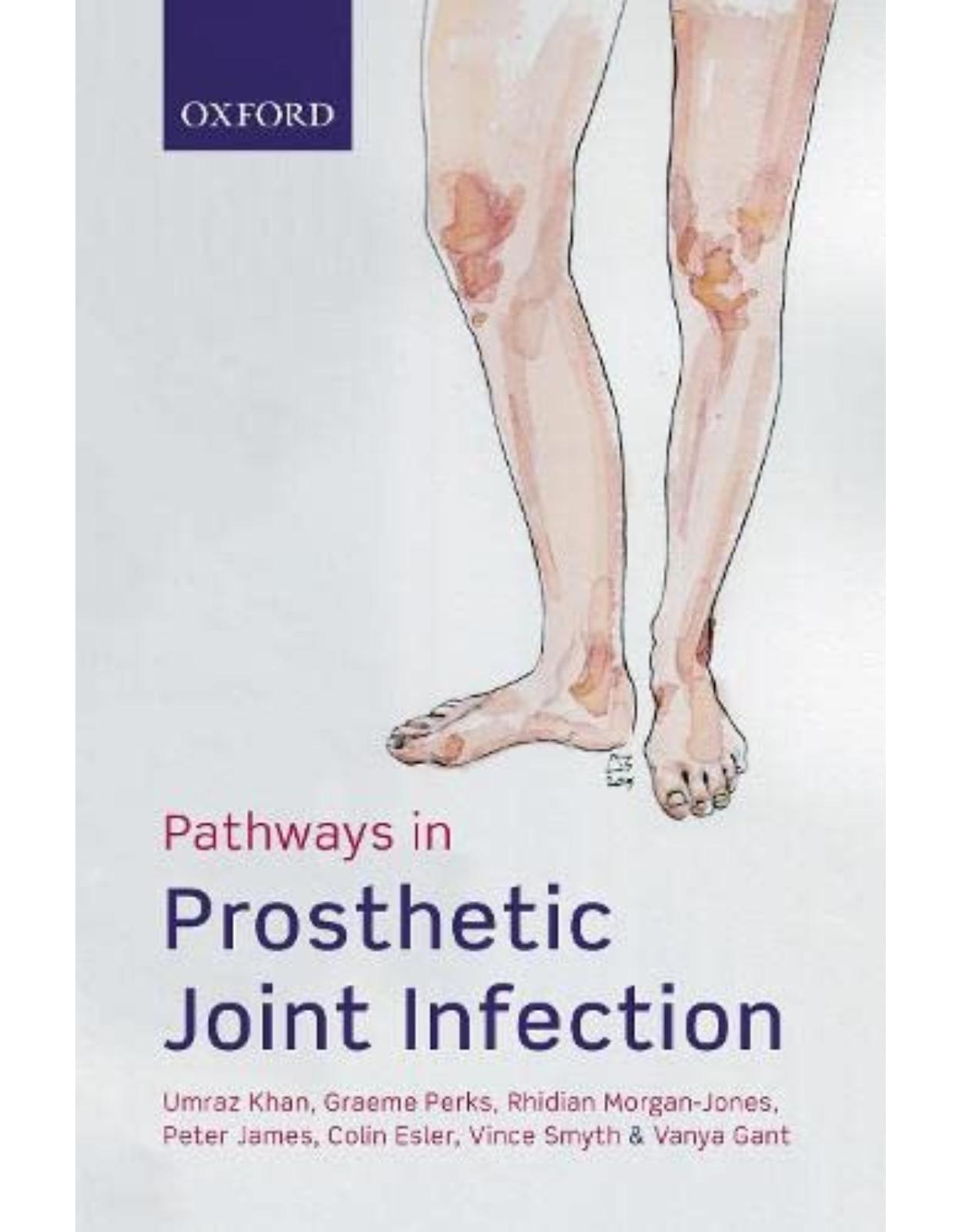 Pathways in Prosthetic Joint Infection