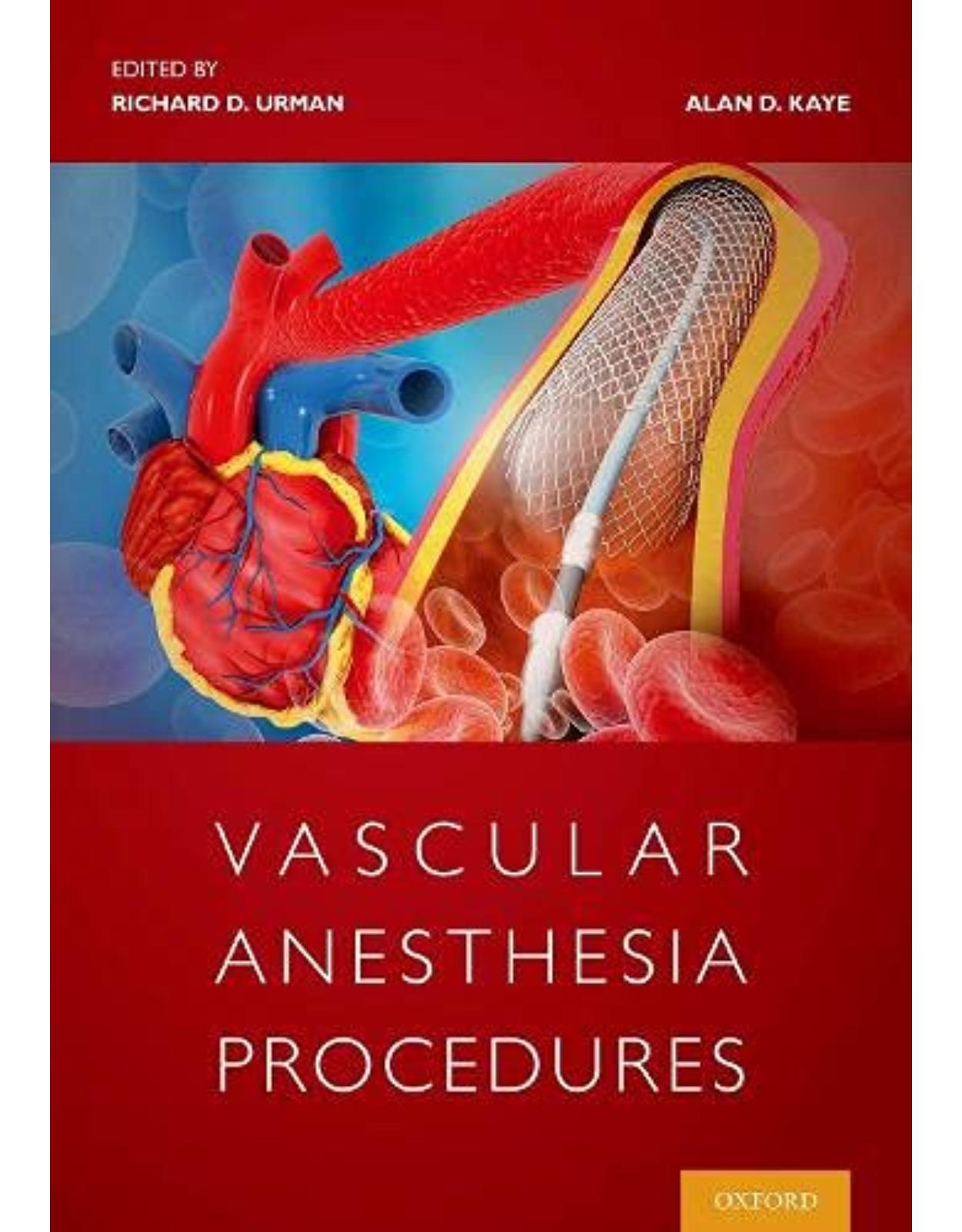 Vascular Anesthesia Procedures