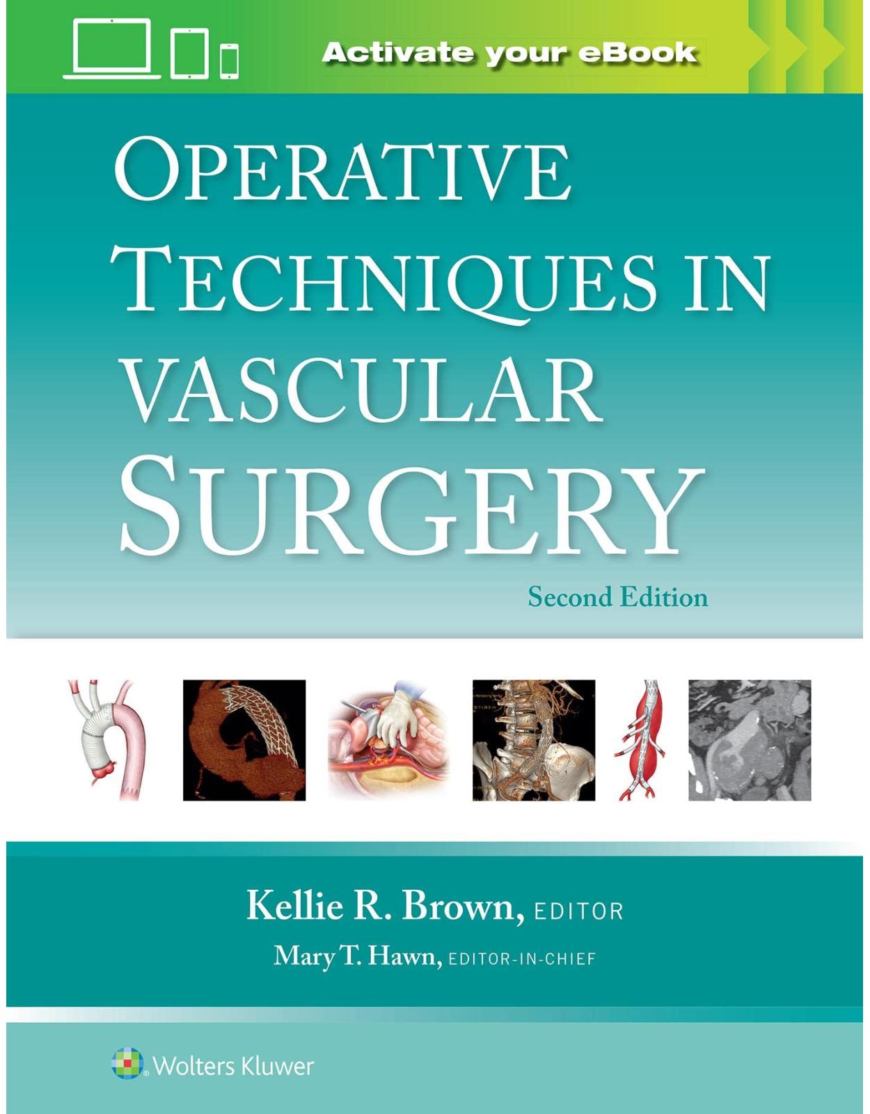 Operative Techniques in Vascular Surgery