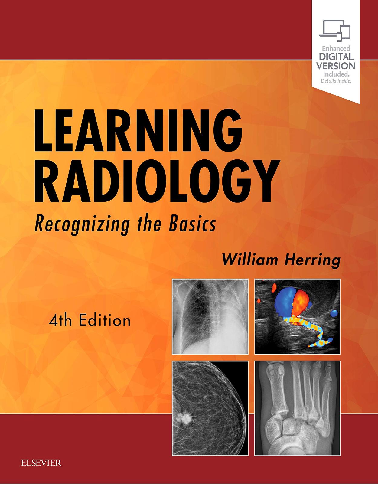 Learning Radiology: Recognizing the Basics