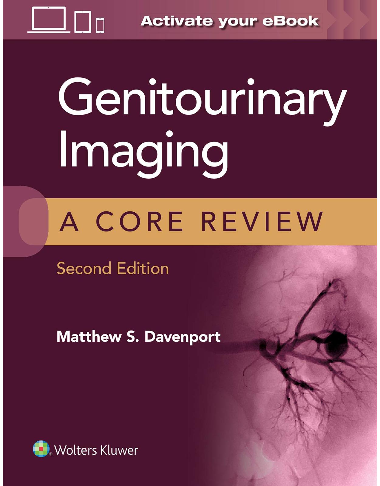 Genitourinary Imaging: A Core Review