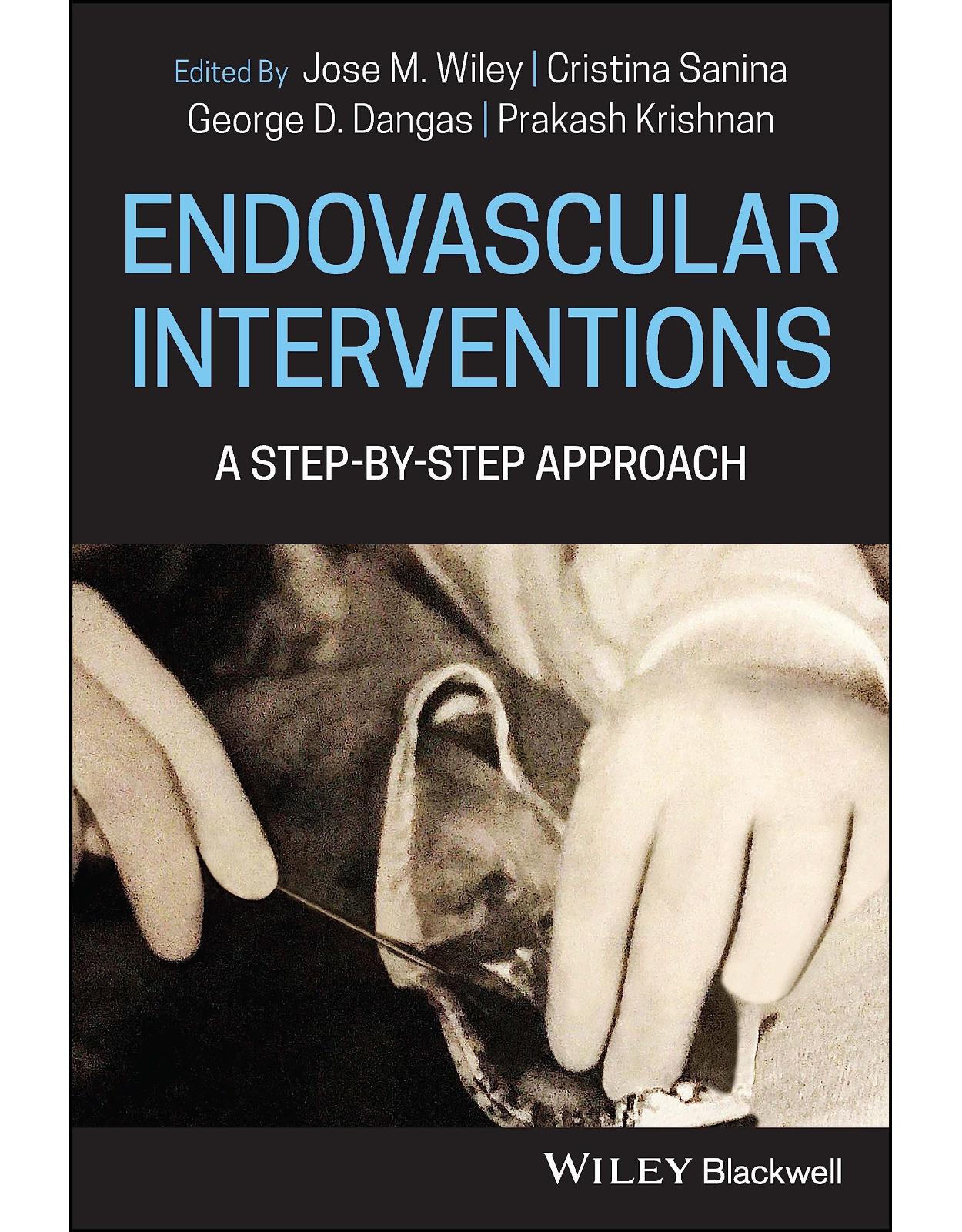 Endovascular Procedures A Step–by–Step Approach