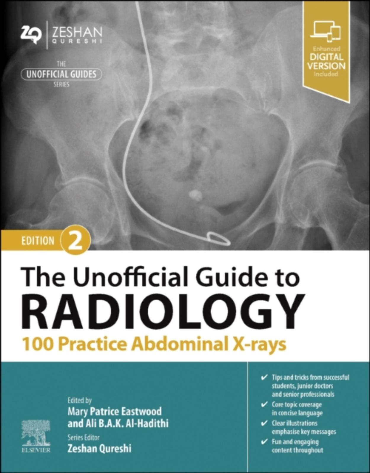 The Unofficial Guide to Radiology: 100 Practice Abdominal X-rays 