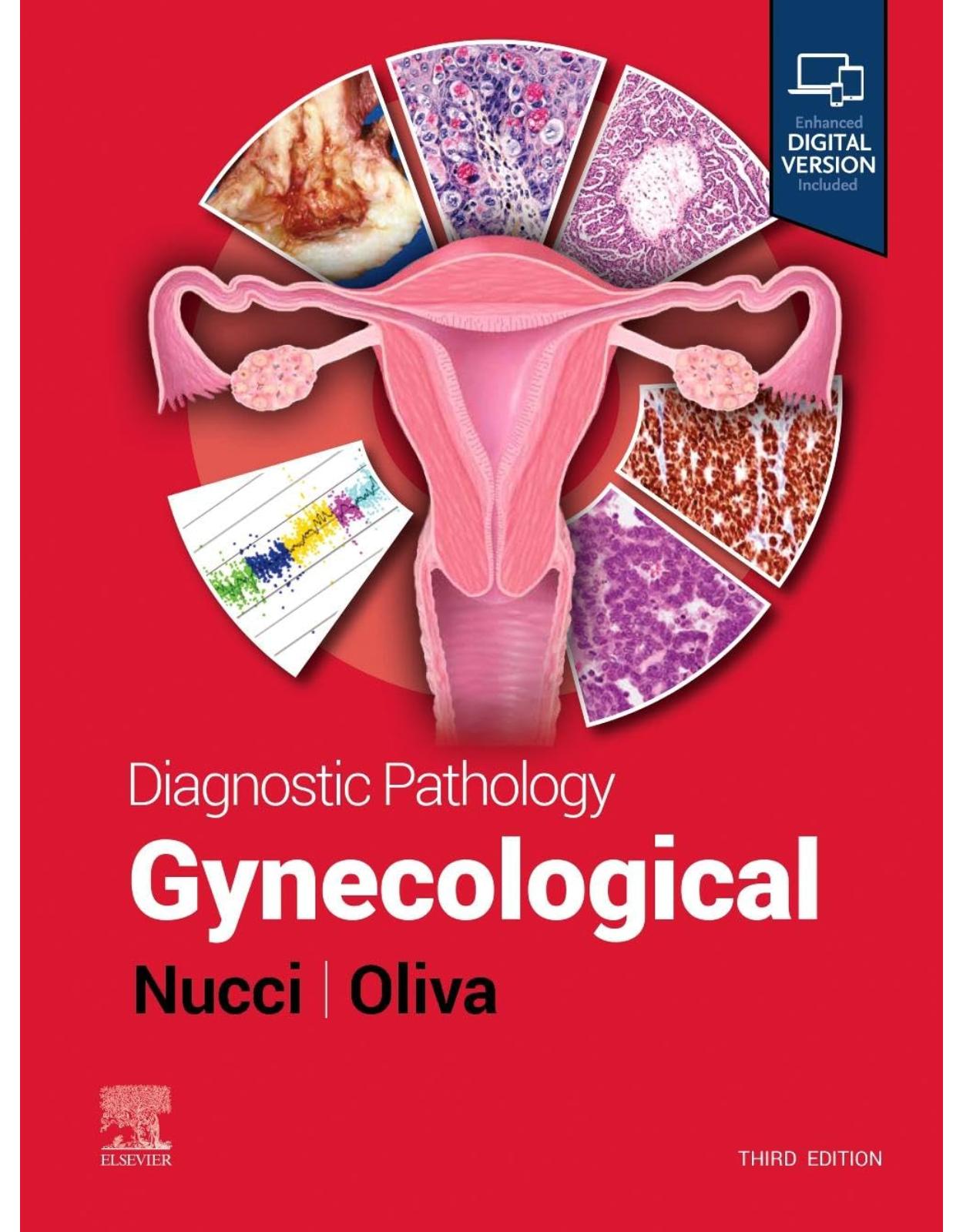 Diagnostic Pathology: Gynecological