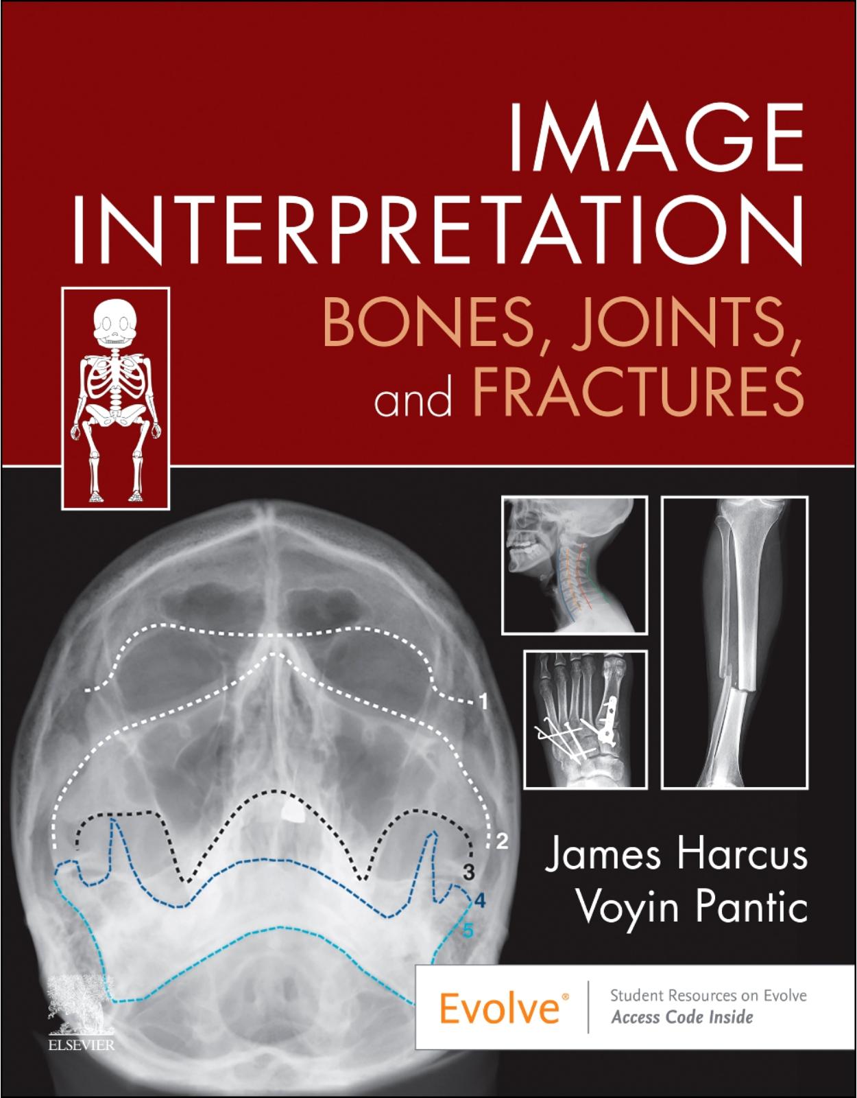 Image Interpretation: Bones, Joints, and Fractures, 1st Edition