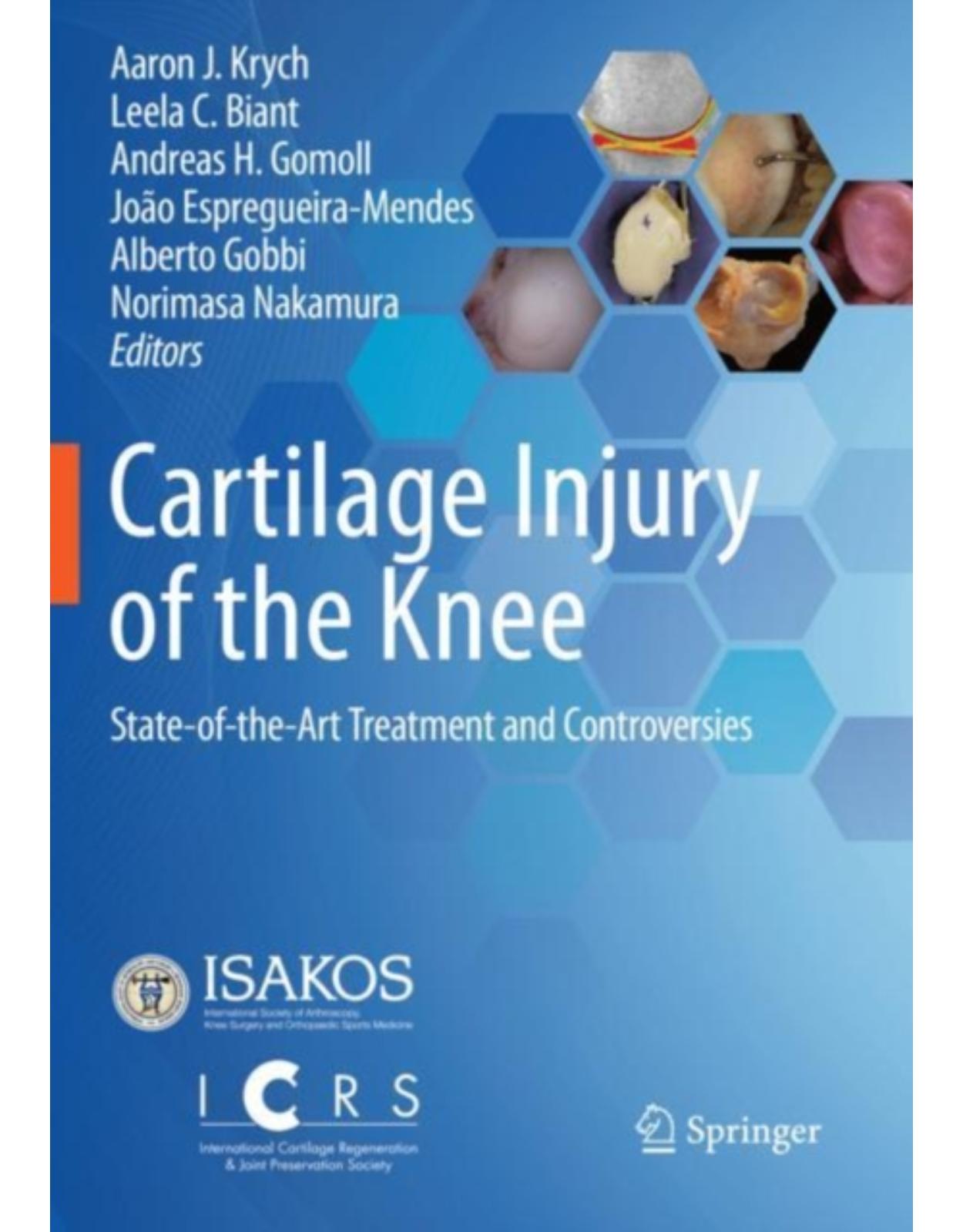 Cartilage Injury of the Knee