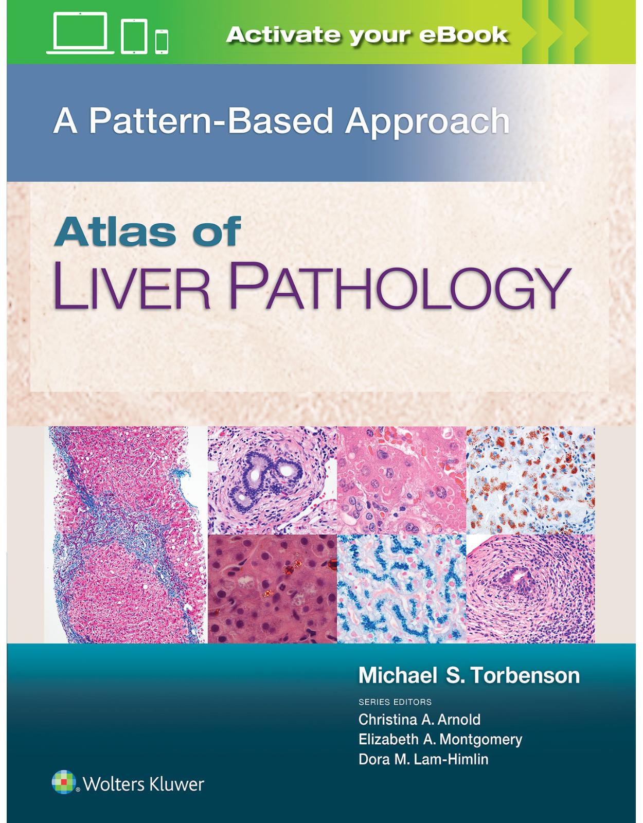 Atlas of Liver Pathology: A Pattern-Based Approach