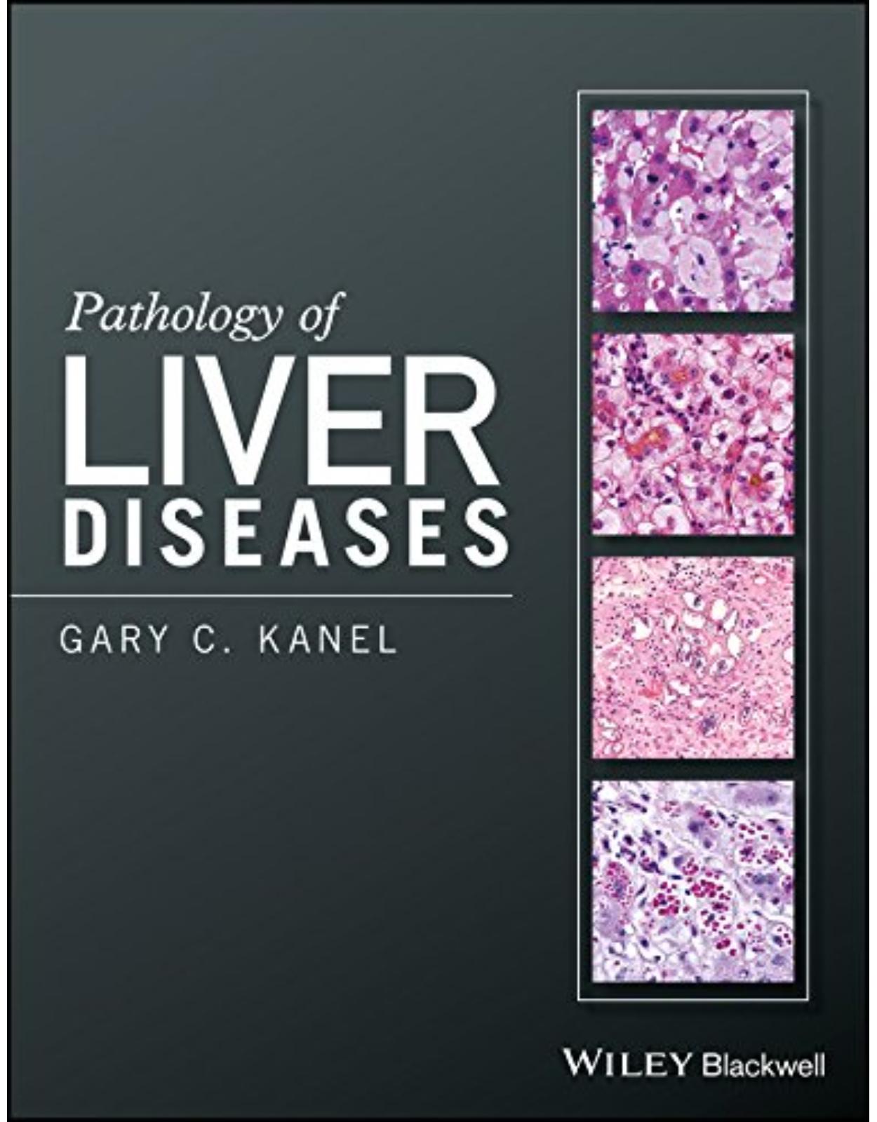 Pathology of Liver Diseases