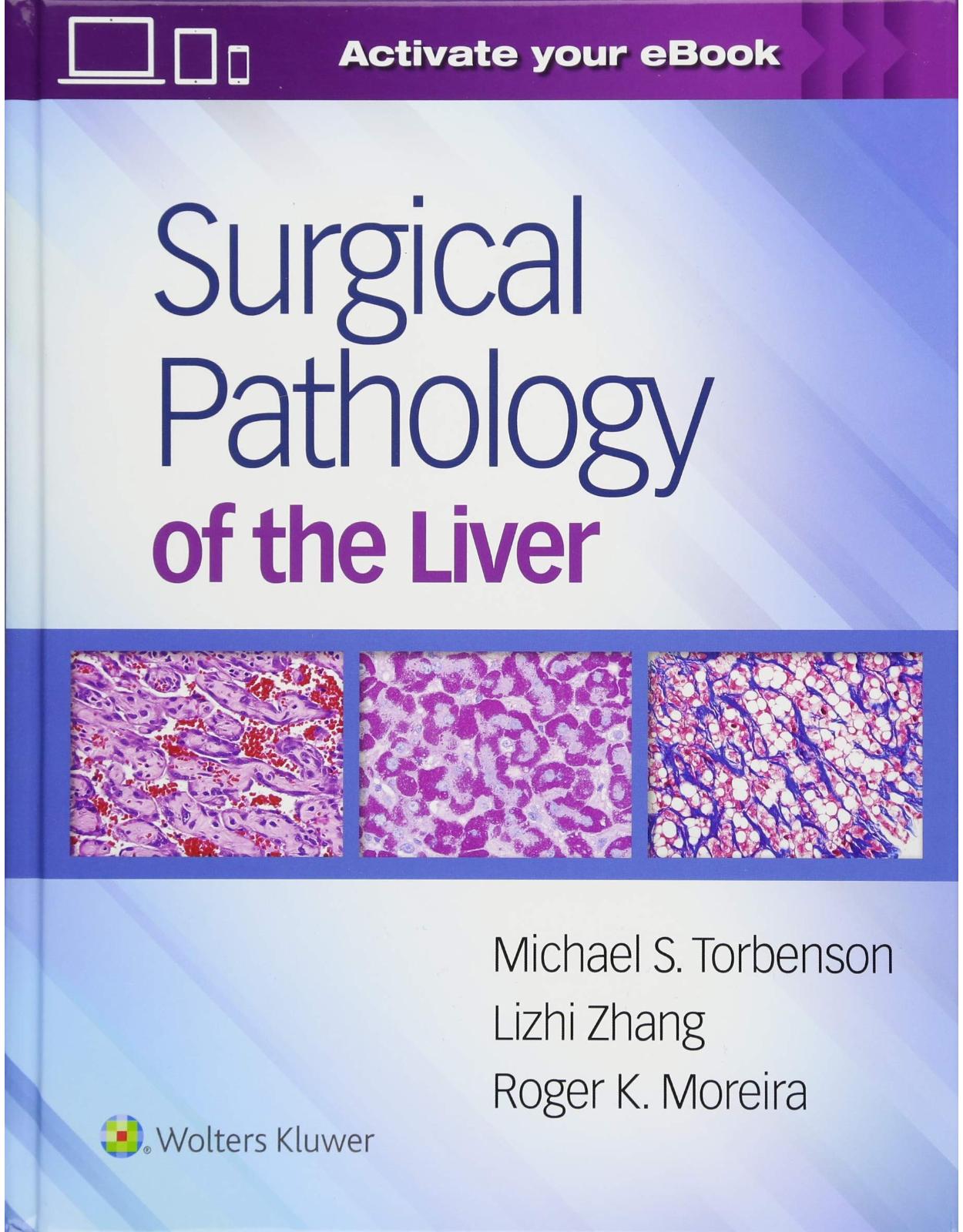 Surgical Pathology of the Liver 