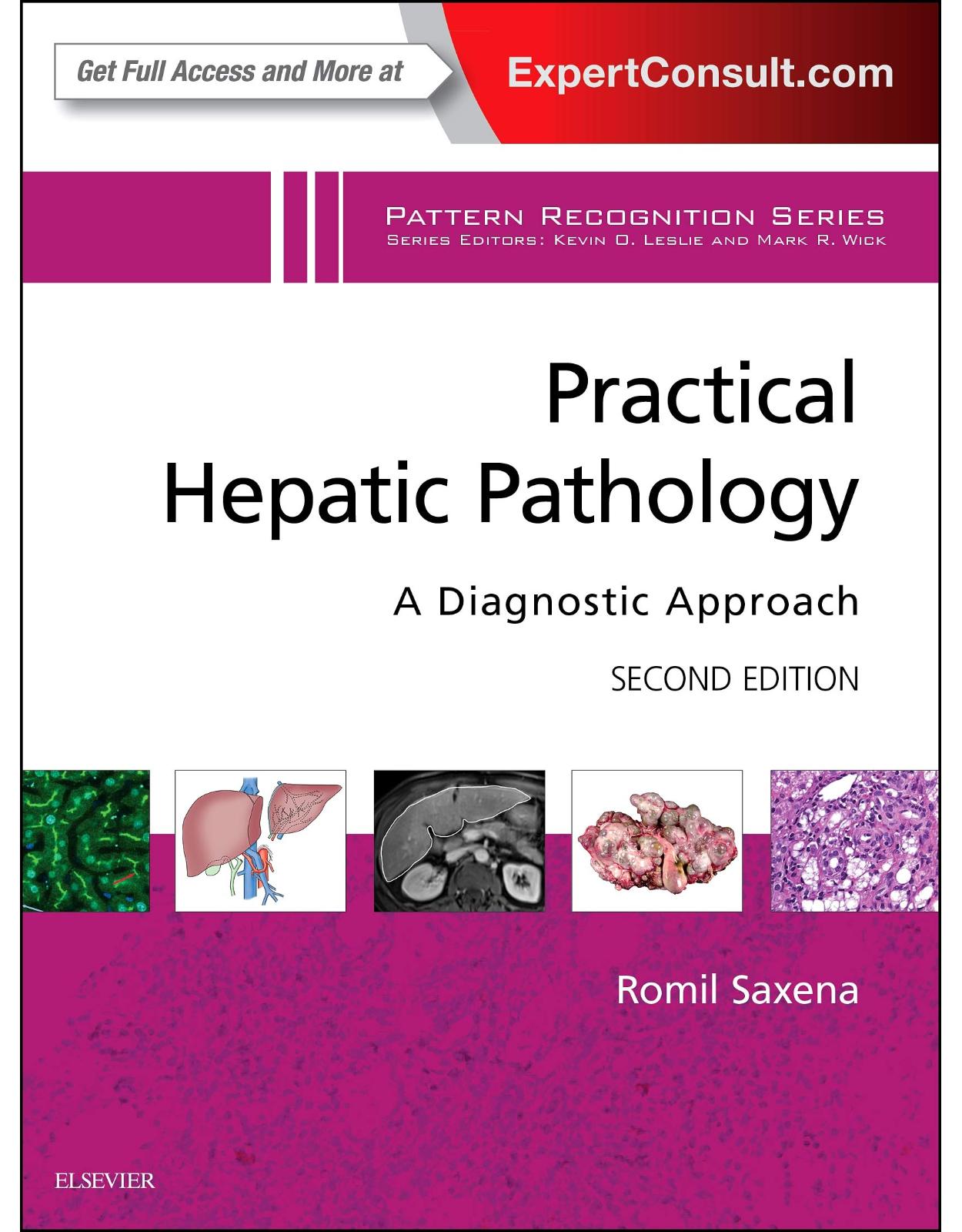 Practical Hepatic Pathology: A Diagnostic Approach: A Volume in the Pattern Recognition Series