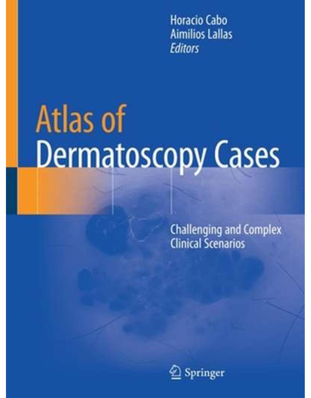 Atlas of Dermatoscopy Cases