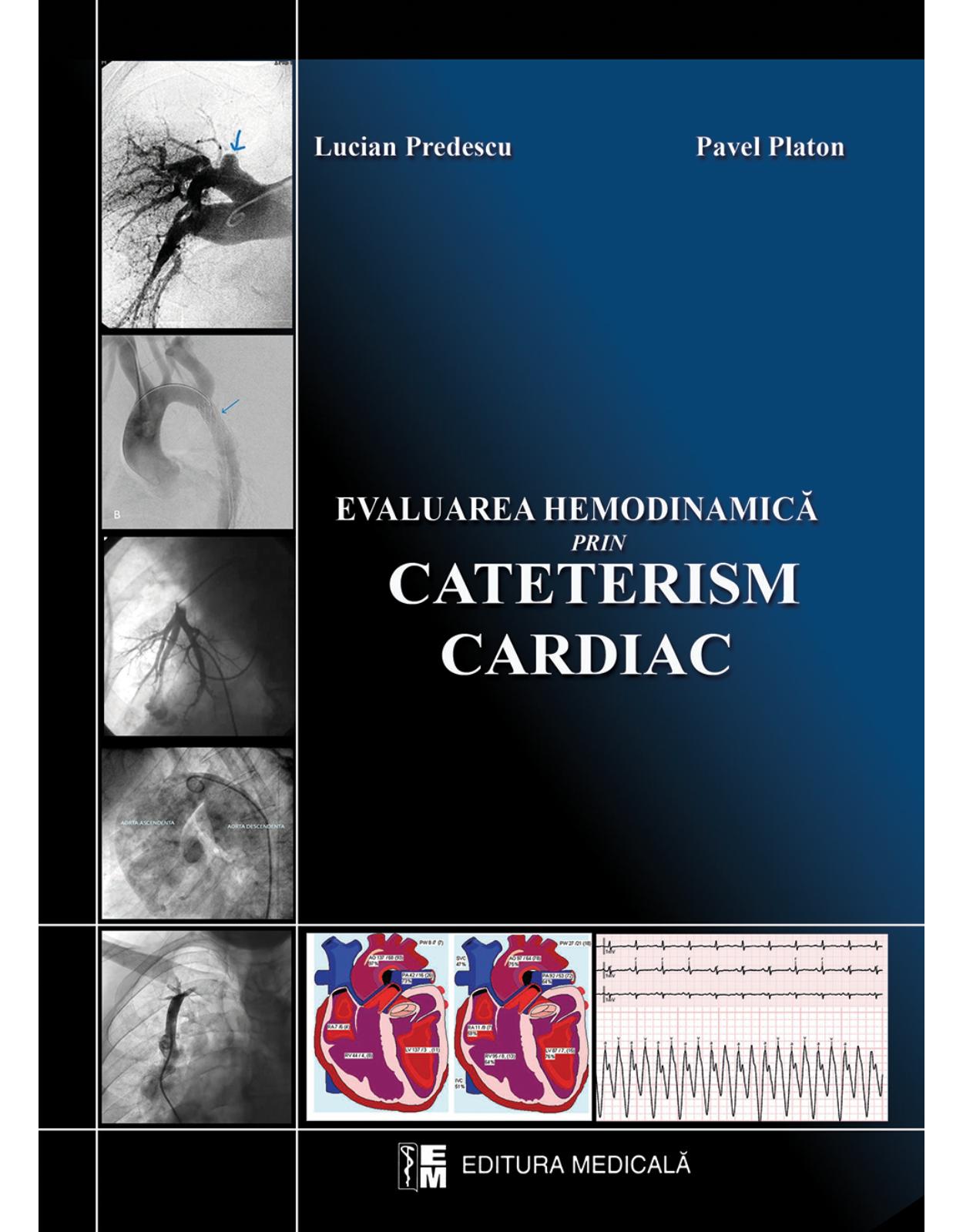 Evaluarea hemodinamica prin cateterism cardiac