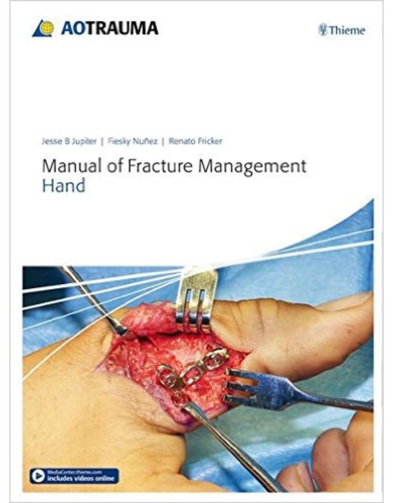 Manual of Fracture Management – Hand