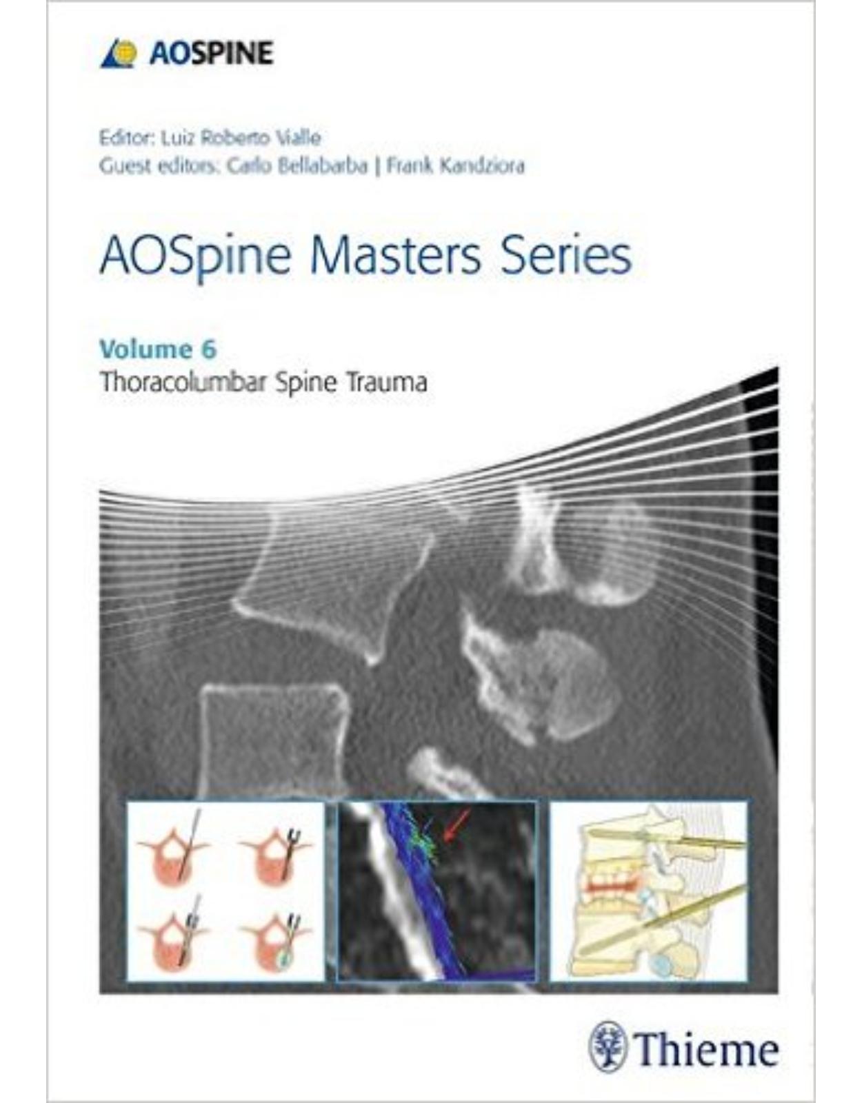 AOSpine Masters Series, Volume 6: Thoracolumbar Spine Trauma