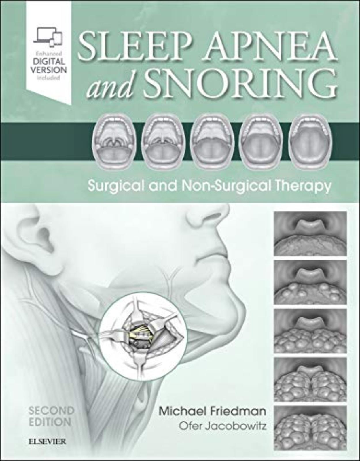 Sleep Apnea and Snoring: Surgical and Non-Surgical Therapy, 2e