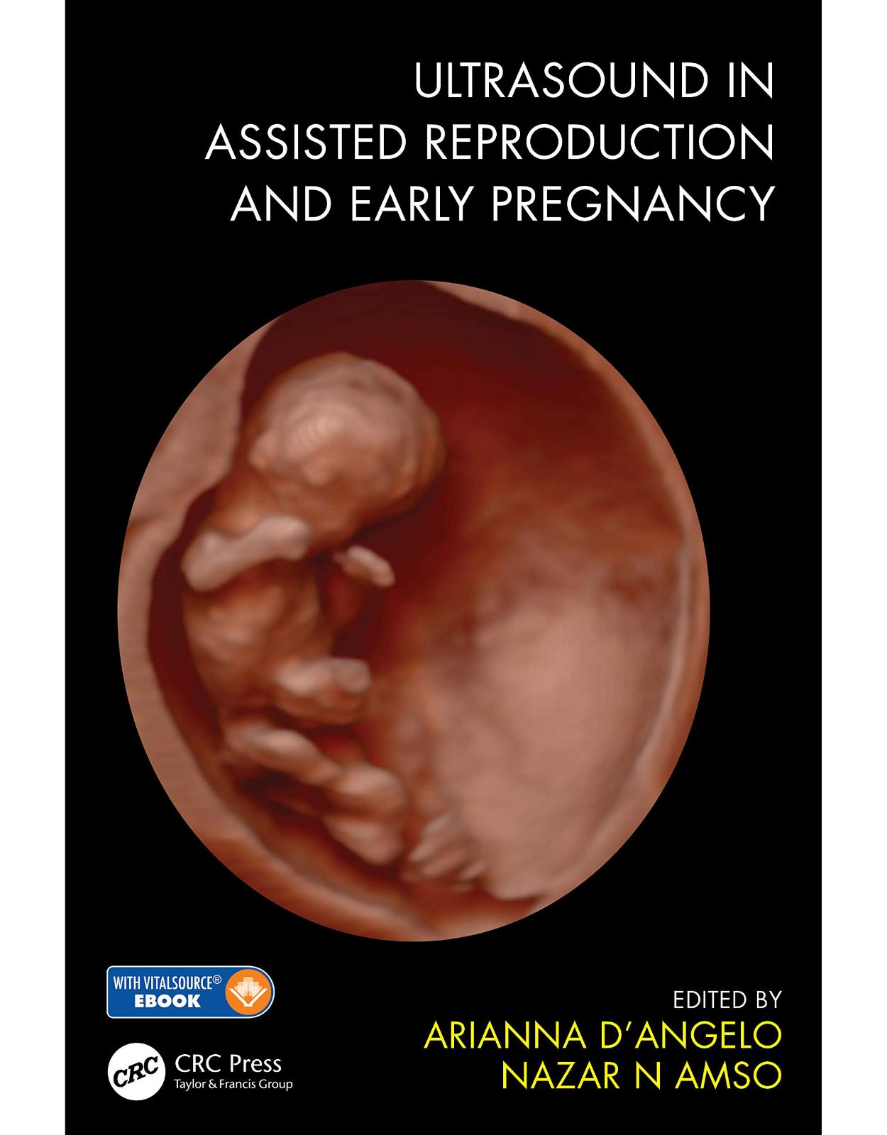 Ultrasound in Assisted Reproduction and Early Pregnancy