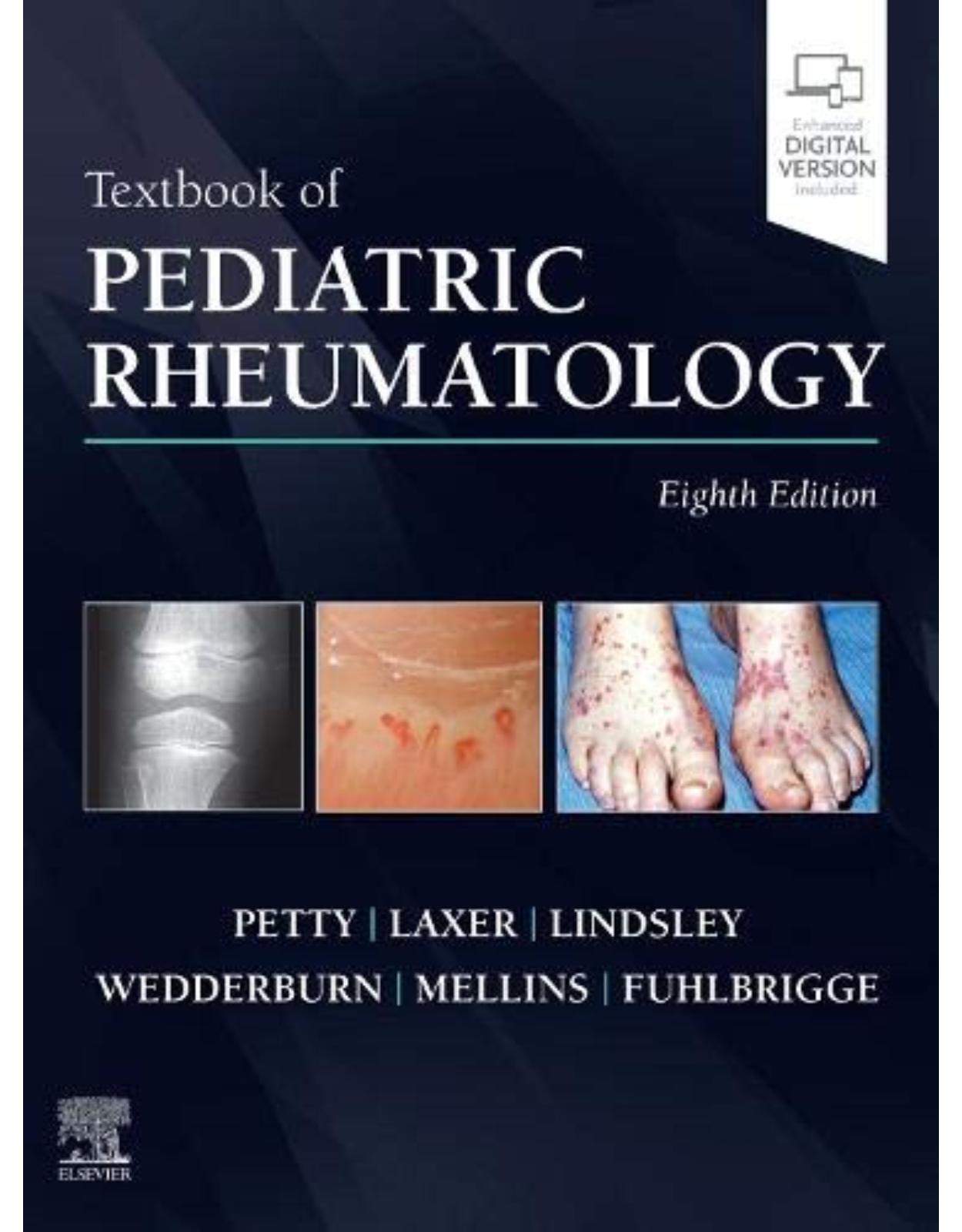 Textbook of Pediatric Rheumatology