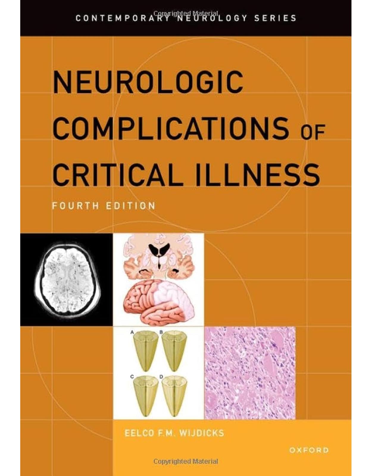 Neurologic Complications of Critical Illness