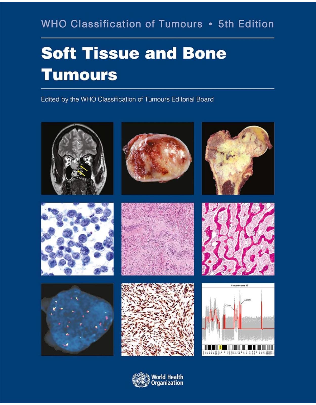Soft Tissue and Bone Tumours. WHO Classification of Tumours, 5th Edition, Volume 3