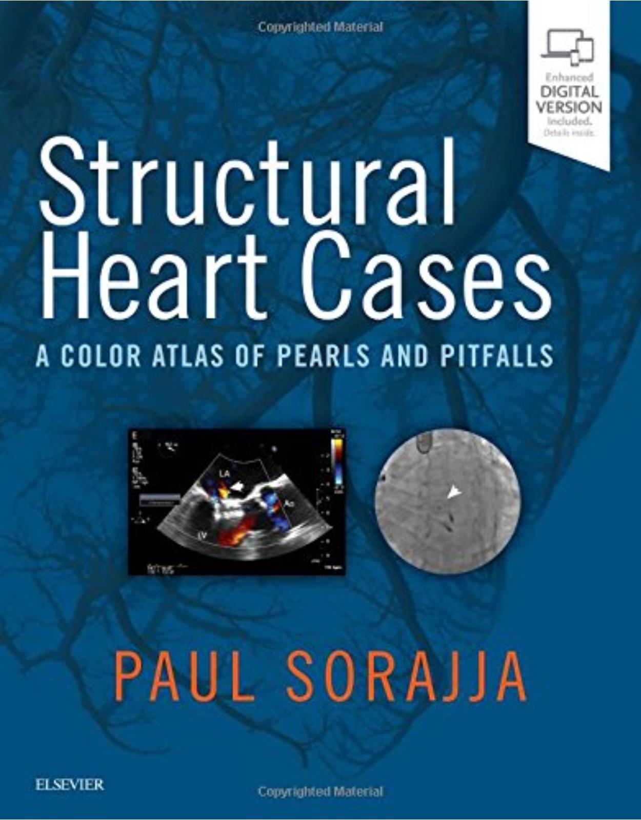 Structural Heart Cases