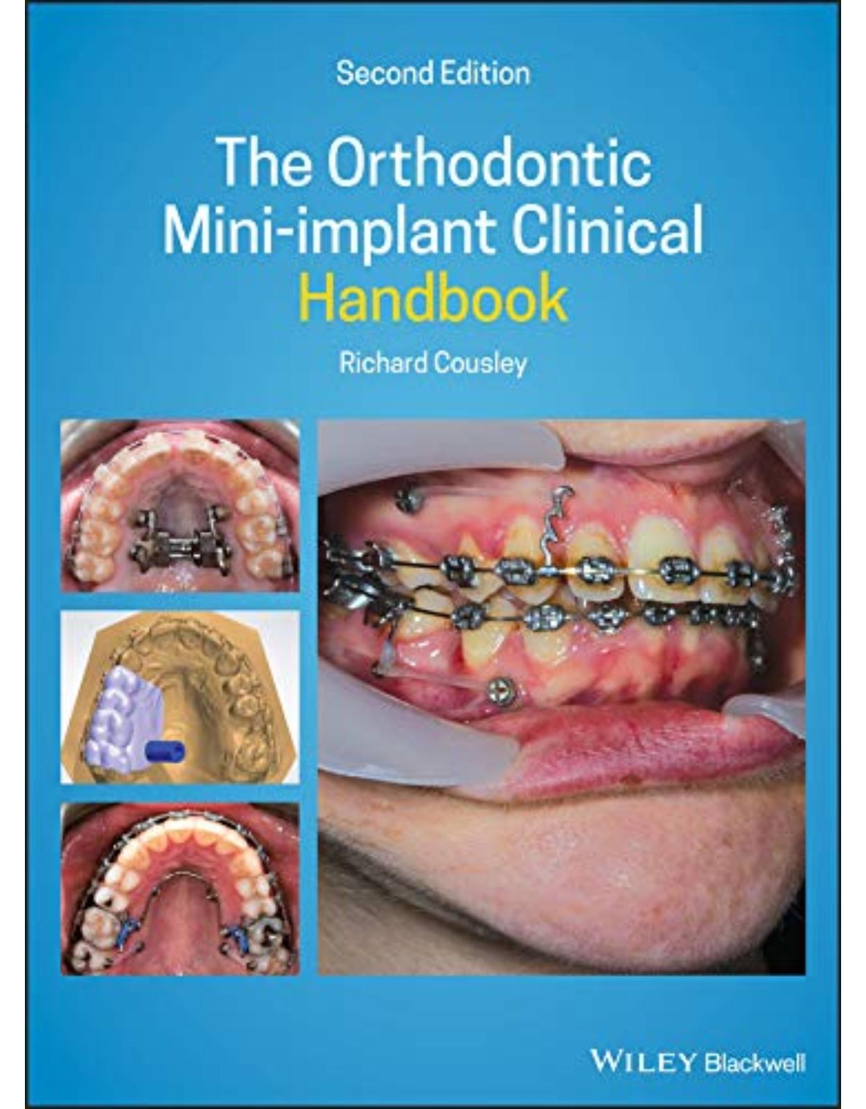 The Orthodontic Mini–implant Clinical Handbook