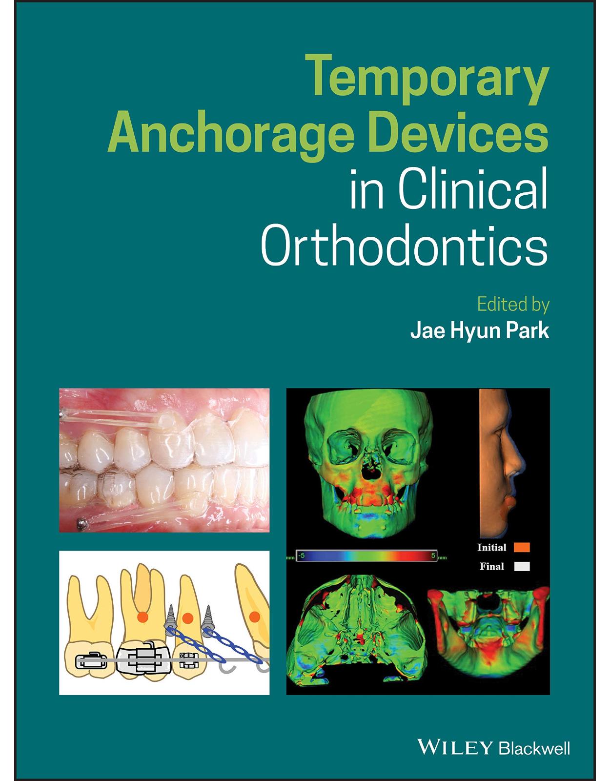 Temporary Anchorage Devices in Clinical Orthodontics