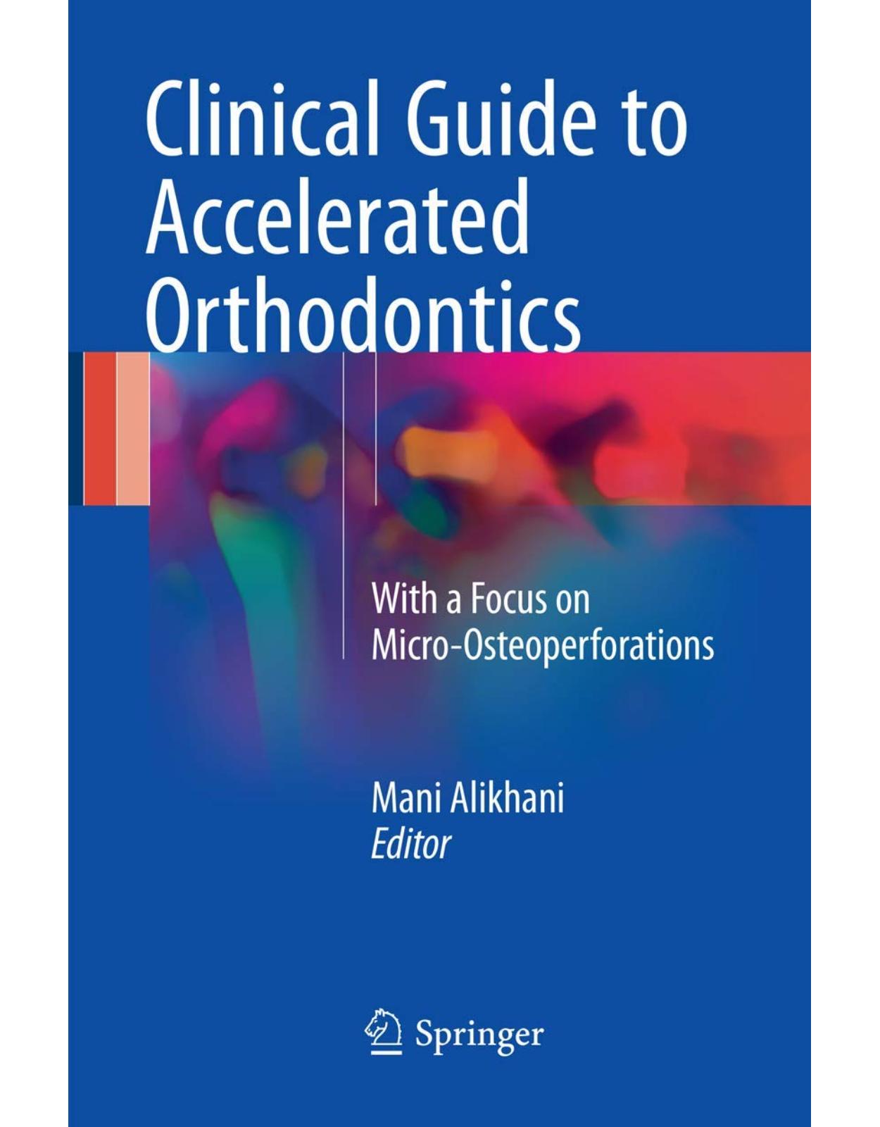 Clinical Guide to Accelerated Orthodontics: With a Focus on Micro-Osteoperforations