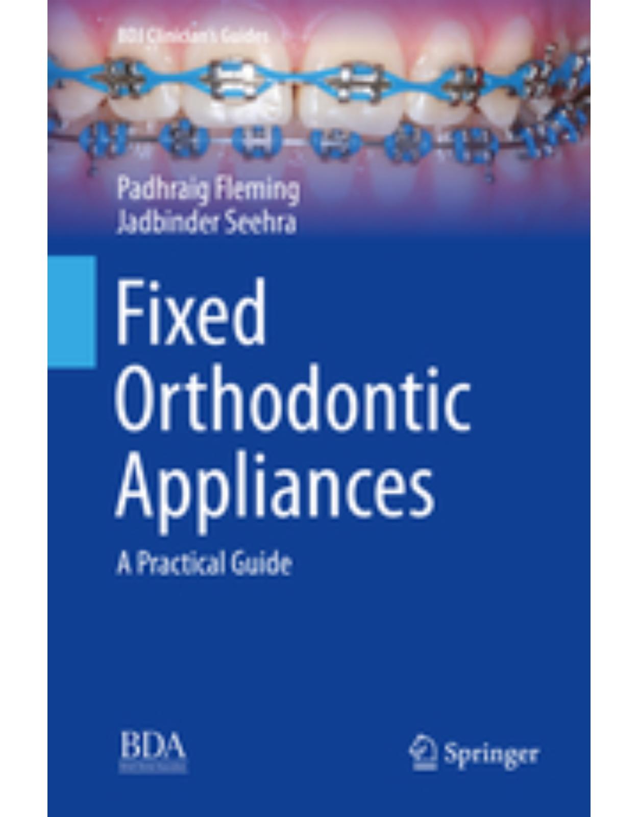 Fixed Orthodontic Appliances