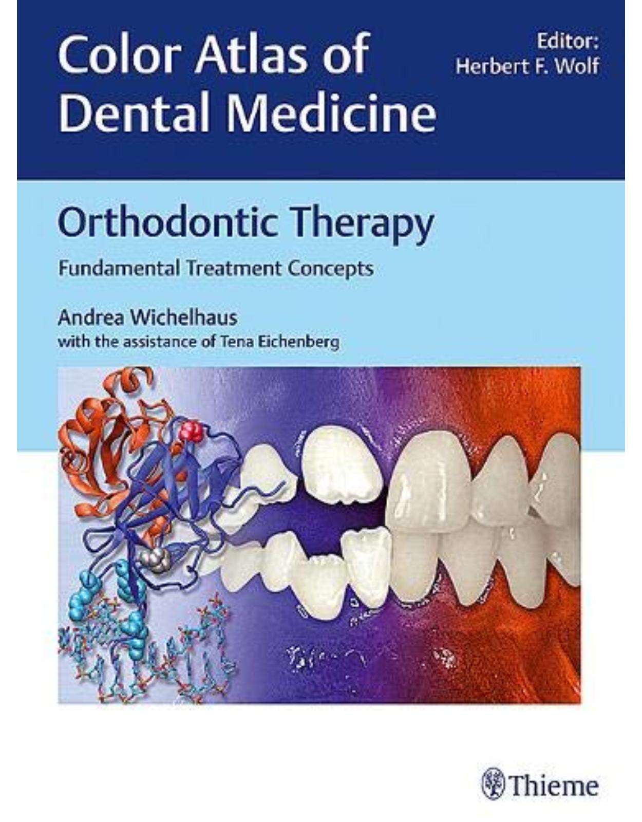 Orthodontic Therapy: Fundamental Treatment Concepts (Color Atlas of Dental Medicine)