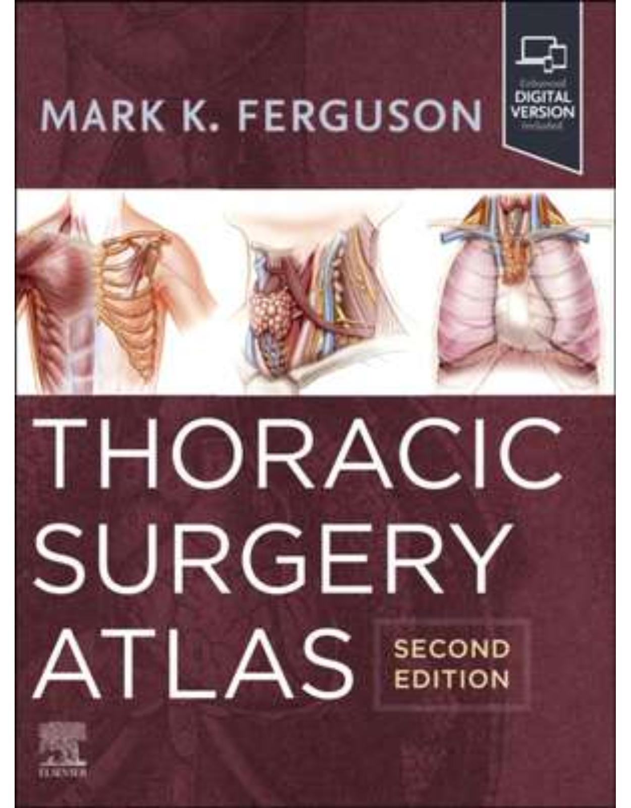 Thoracic Surgery Atlas