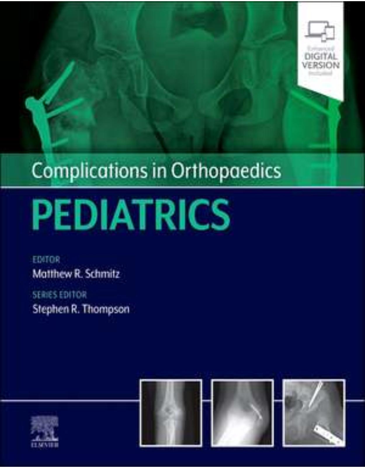 Complications in Orthopaedics: Pediatrics