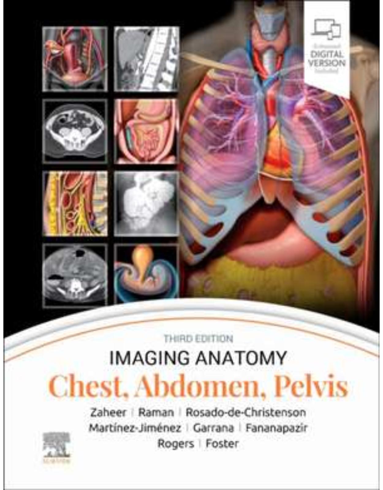 Imaging Anatomy: Chest, Abdomen, Pelvis