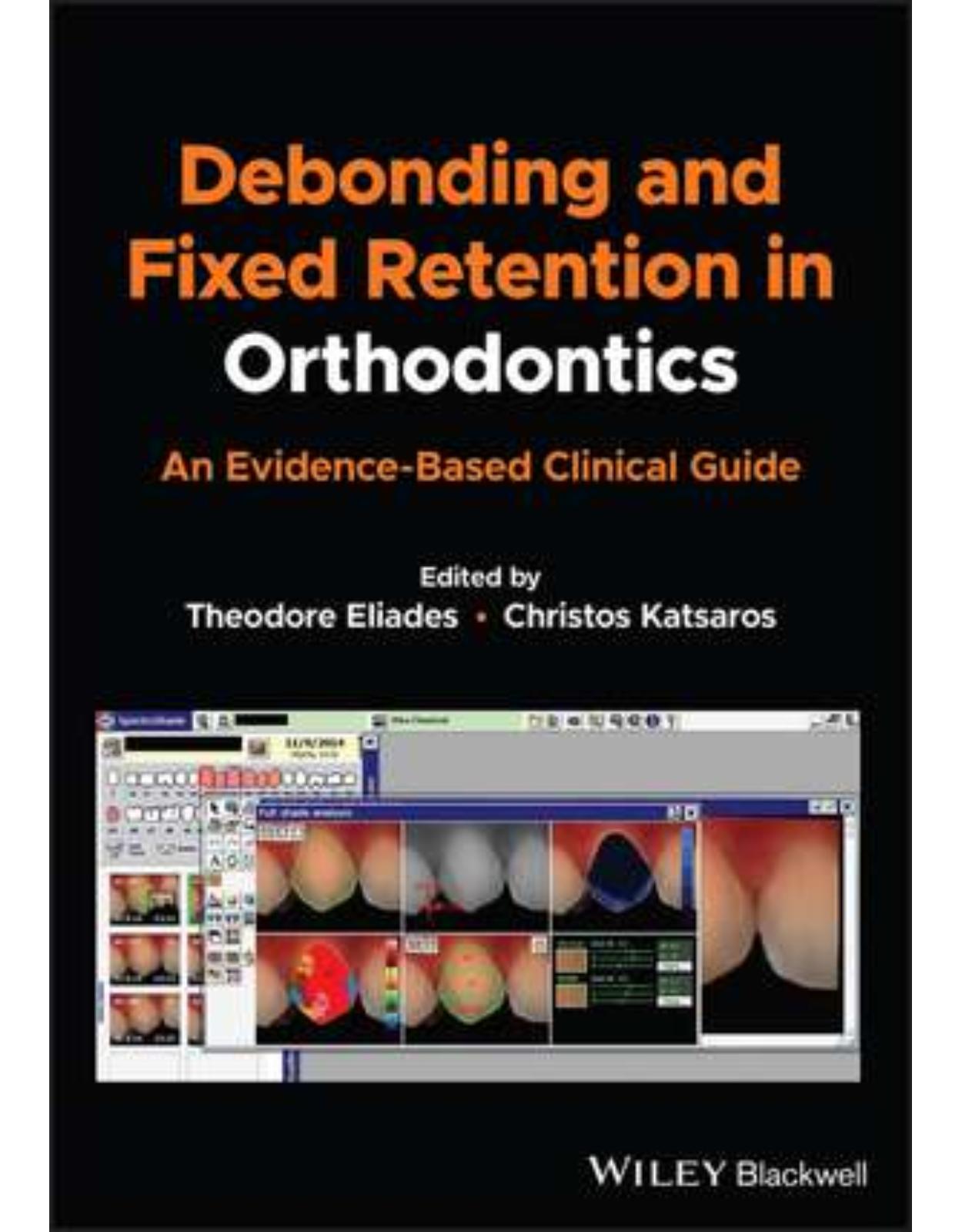 Debonding and Fixed Retention in Orthodontics