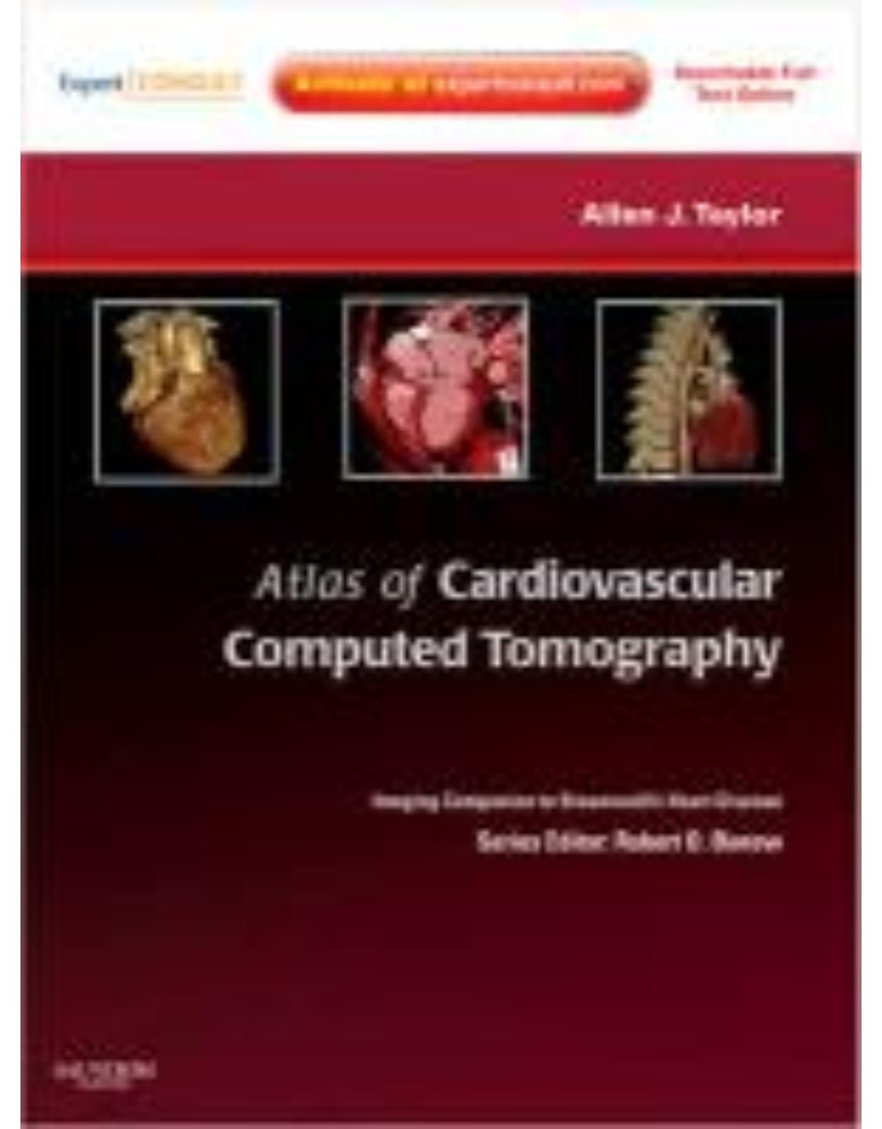 Atlas of Cardiovascular Computed Tomography: Expert Consult - Online and Print: Imaging Companion to Braunwald's Heart Disease