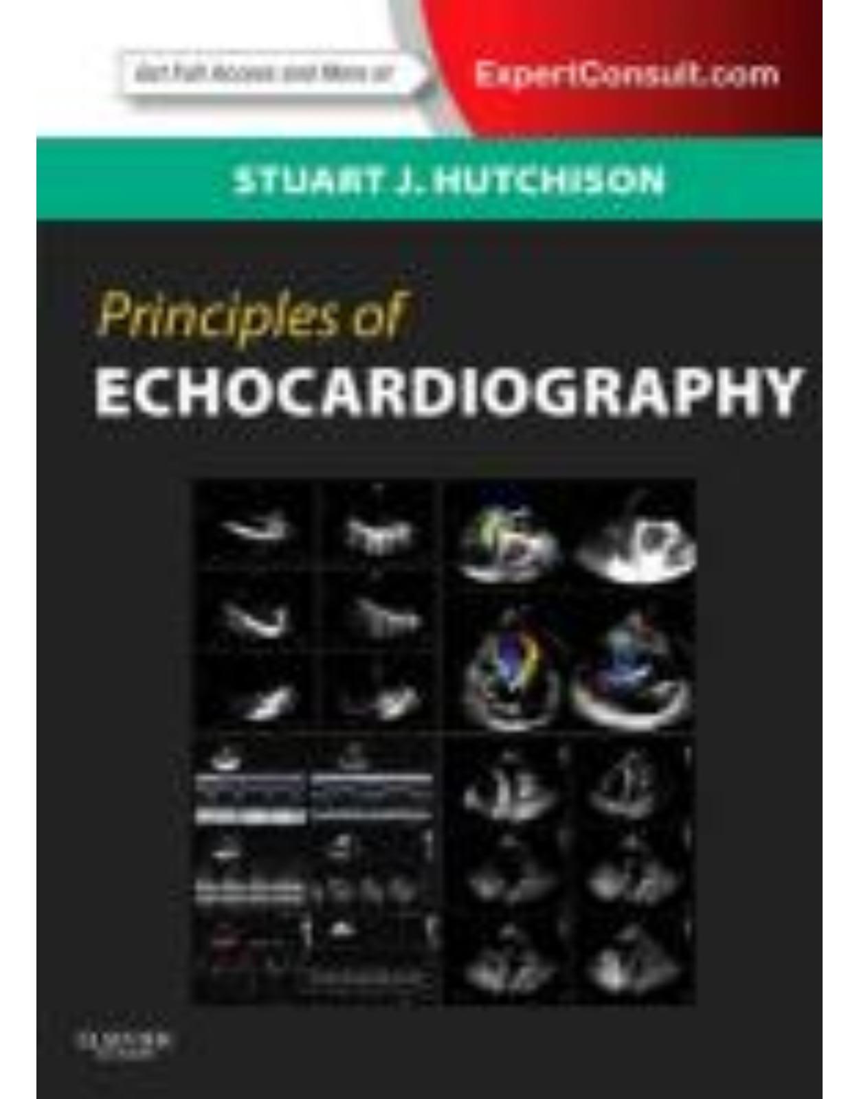 Principles of Echocardiography and Intracardiac Echocardiography Expert Consult – Online and Print