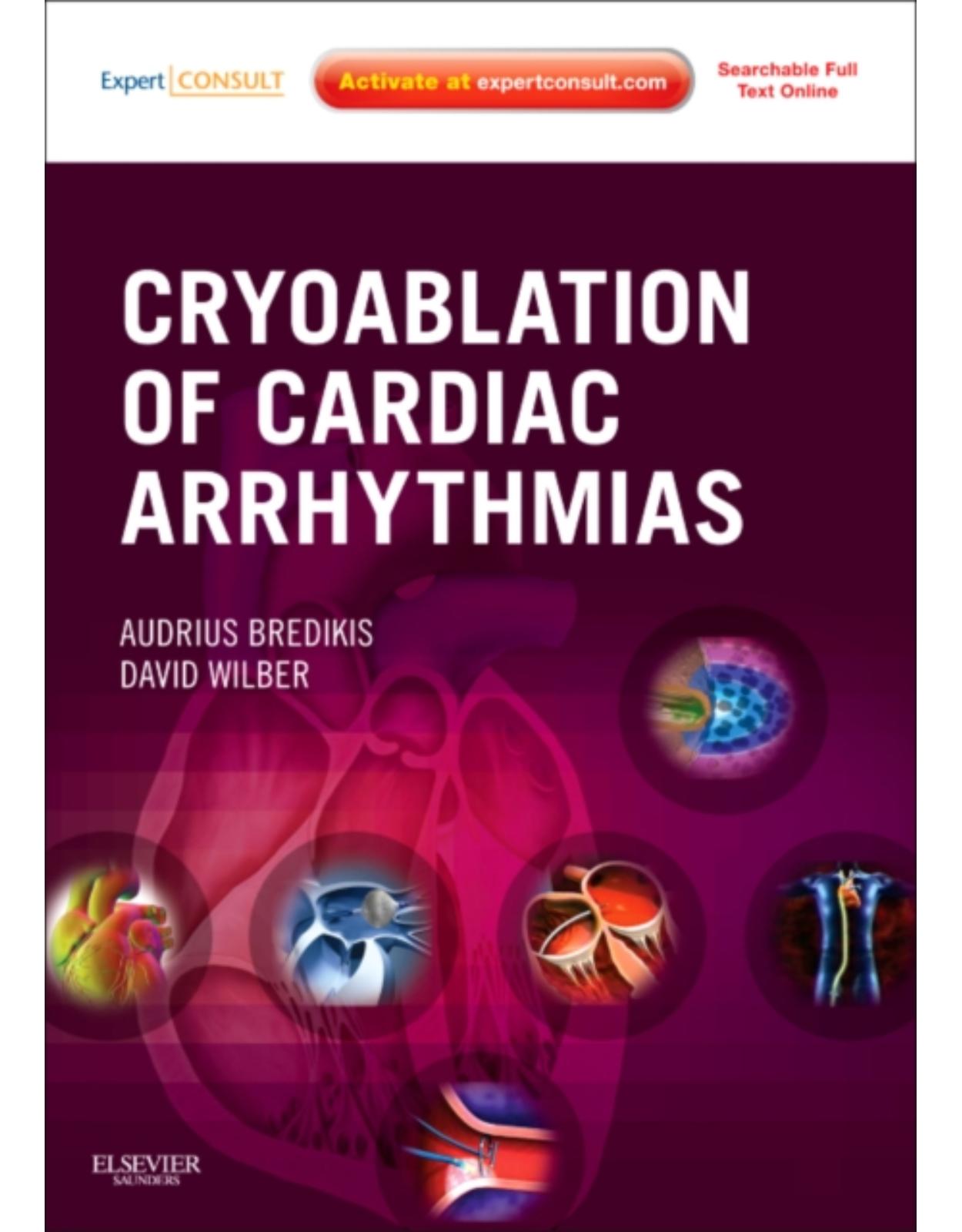 Cryoablation of Cardiac Arrhythmias: Expert Consult - Online and Print