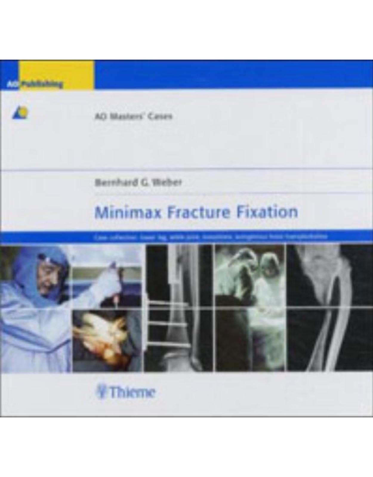 Minimax Fracture Fixation: Case Collection - Lower Leg, Ankle Joint, Nonunions, Autogenous Bone Transplantation
