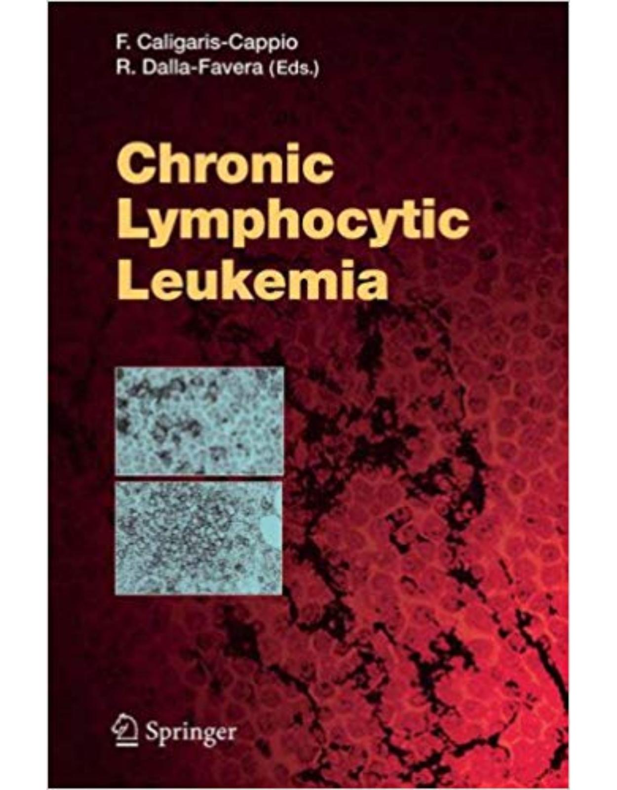 Chronic Lymphocytic Leukemia