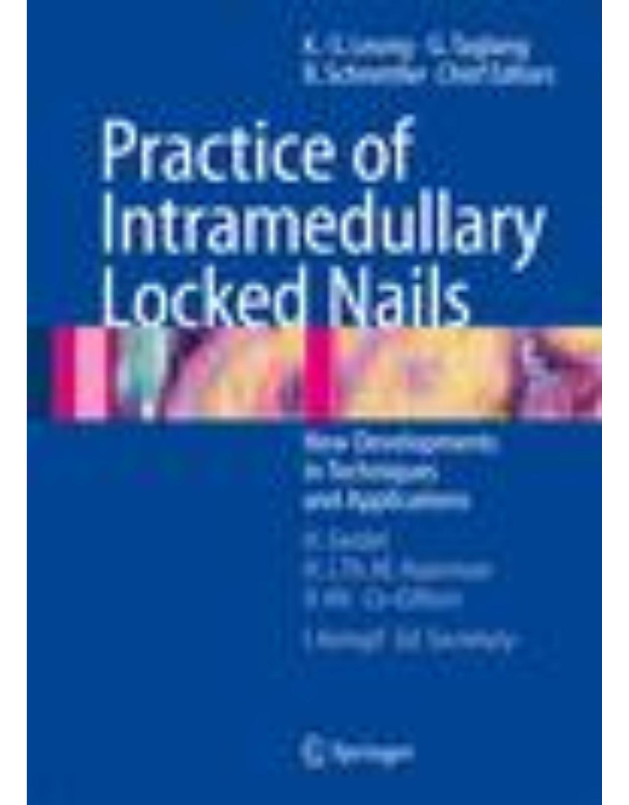 Practice of Intramedullary Locked Nails