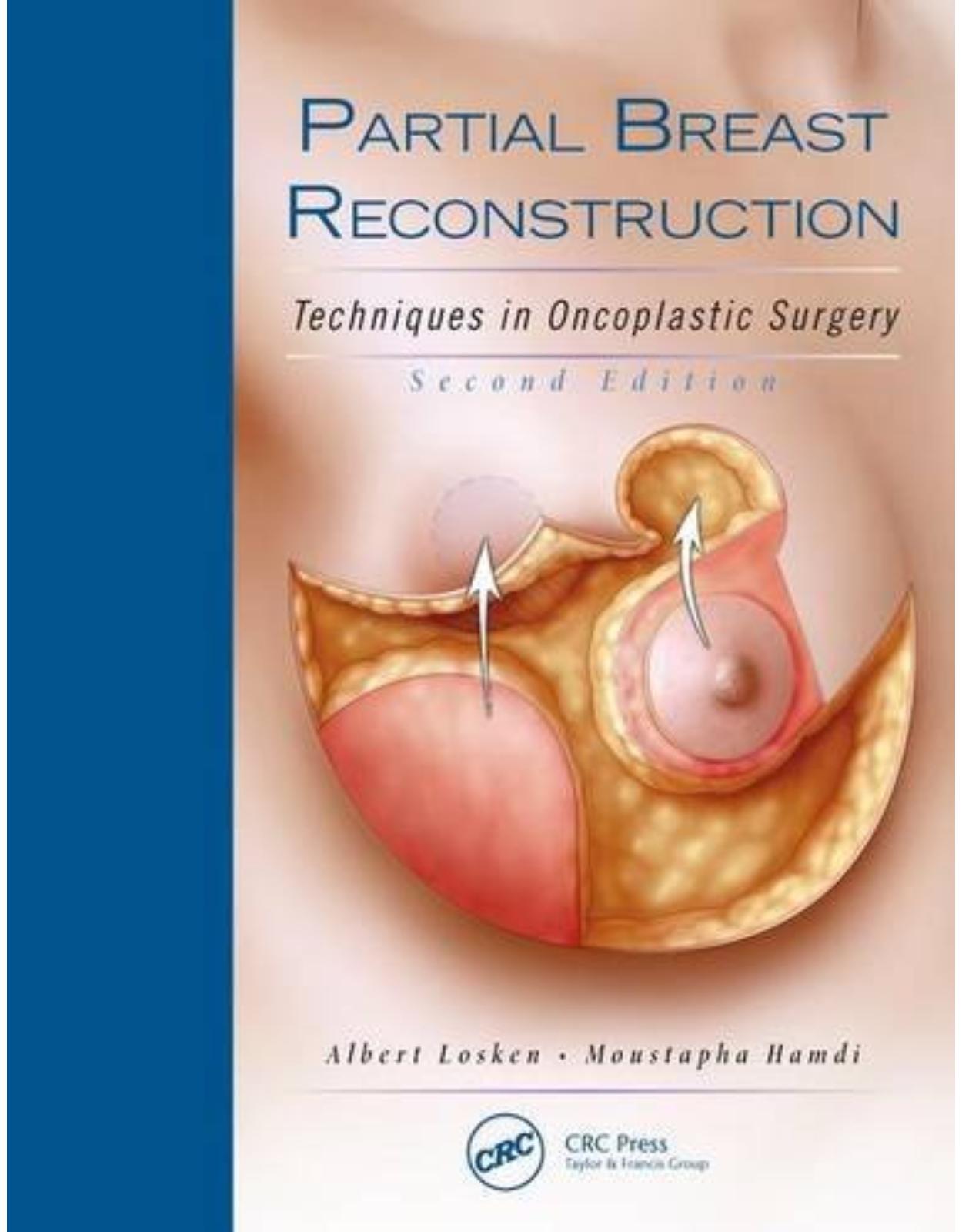 Partial Breast Reconstruction: Techniques in Oncoplastic Surgery, 2nd Edition