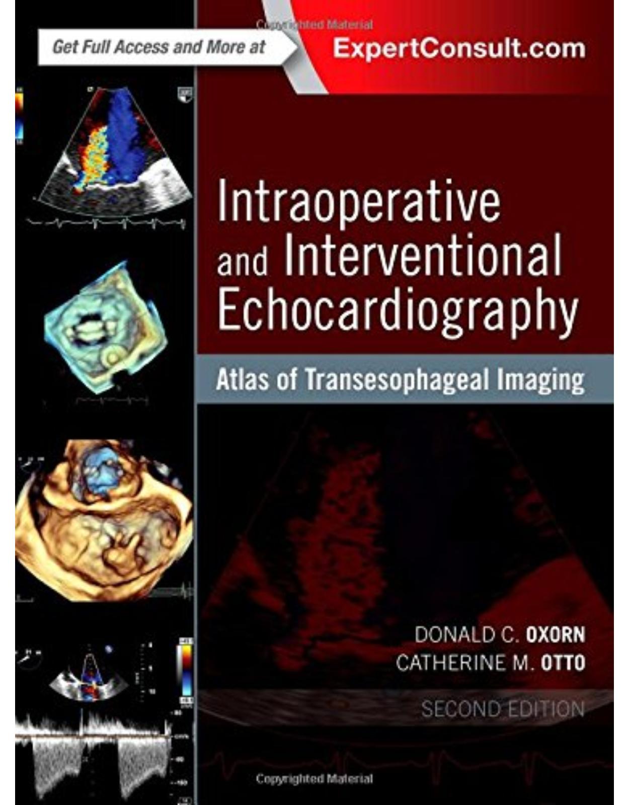 Intraoperative and Interventional Echocardiography: Atlas of Transesophageal Imaging, 2e 