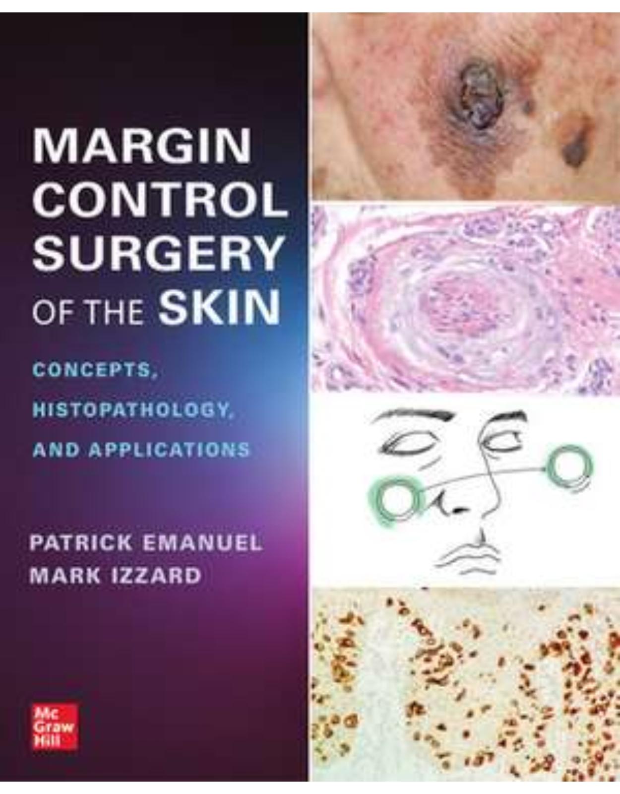 Margin Control Surgery of the Skin