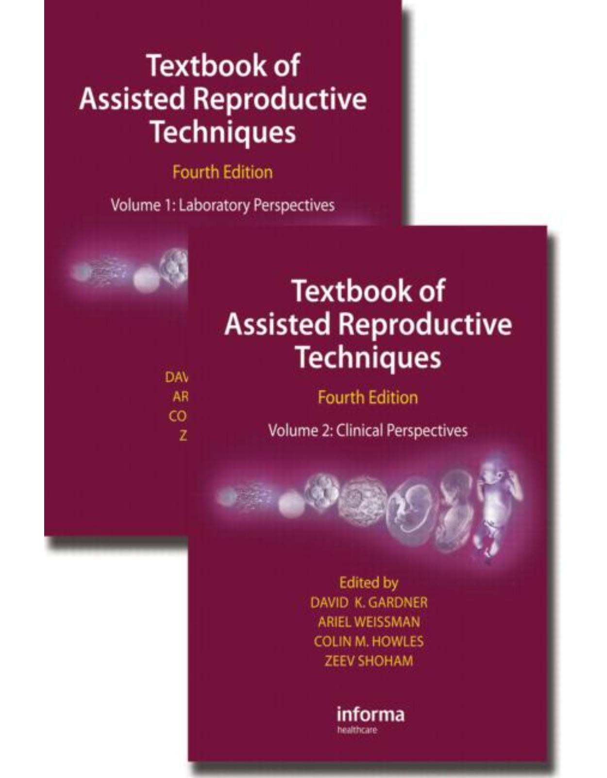  Textbook of Assisted Reproductive Techniques, Fourth Edition (Two Volume Set)