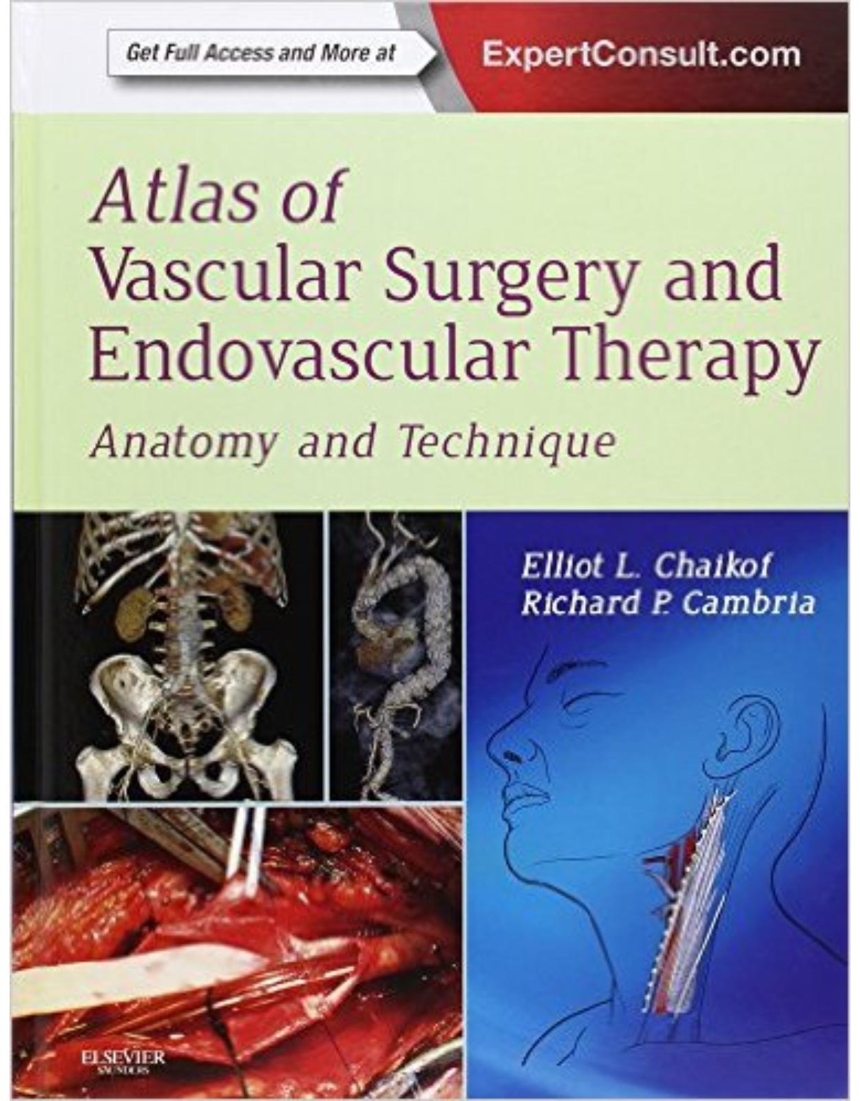 Atlas of Vascular Surgery and Endovascular Therapy: Anatomy and Technique