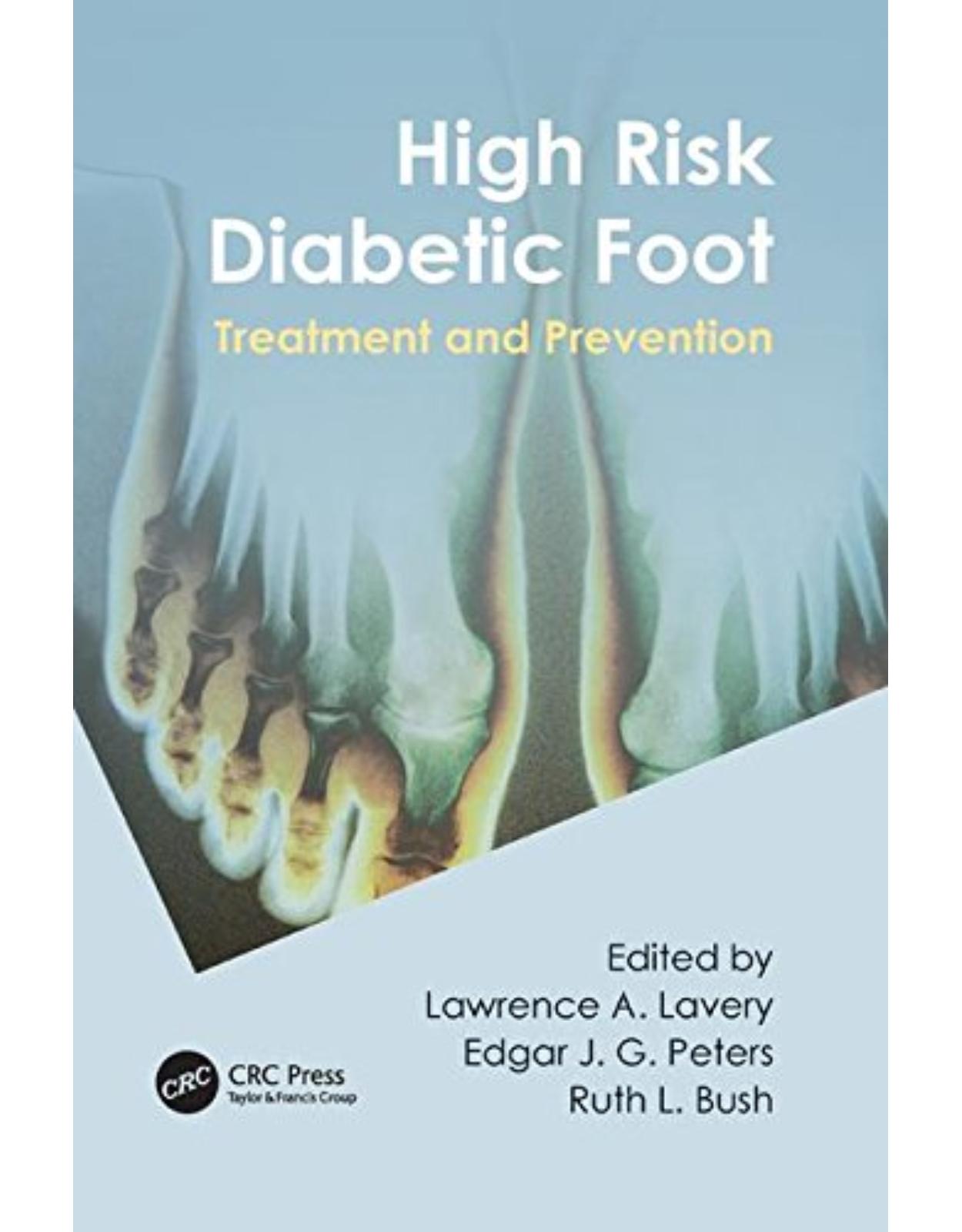 High Risk Diabetic Foot: Treatment and Prevention