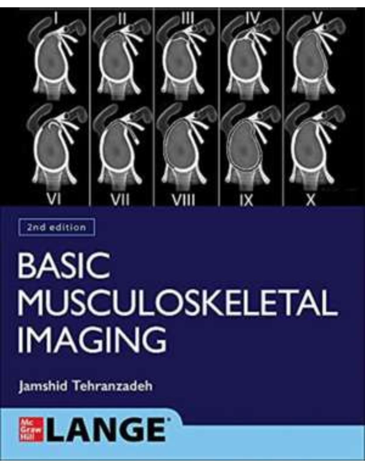 Basic Musculoskeletal Imaging, Second Edition