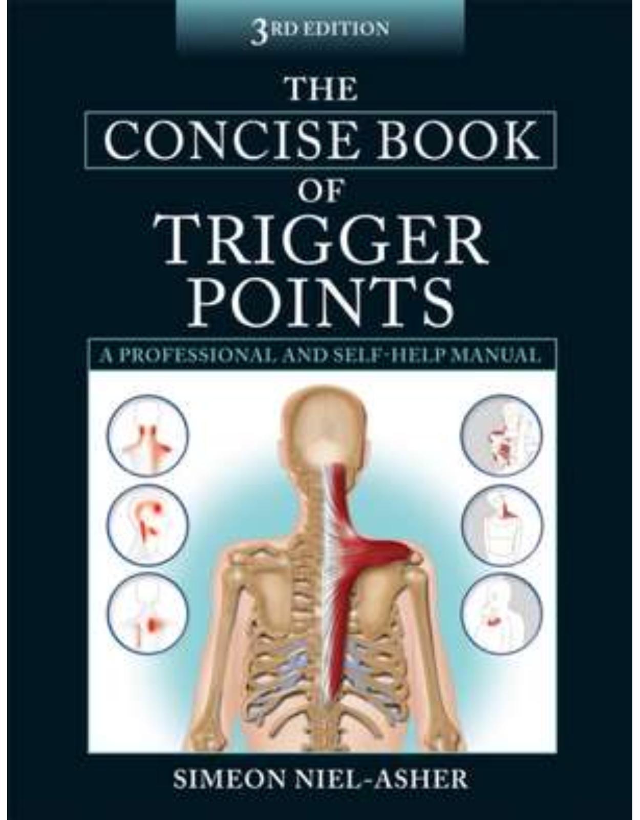 Concise Book of Trigger Points 3rd